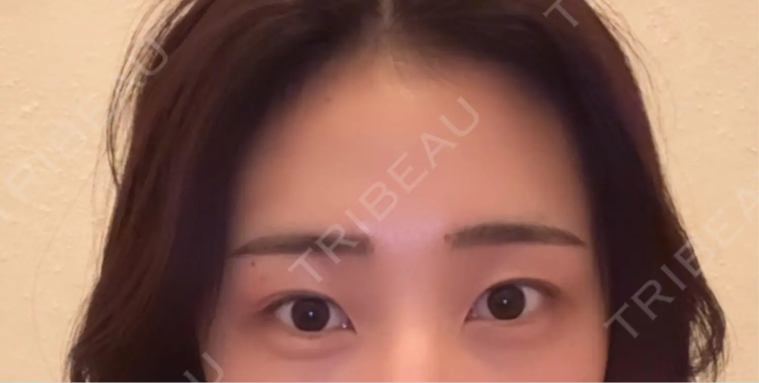 施術前の写真