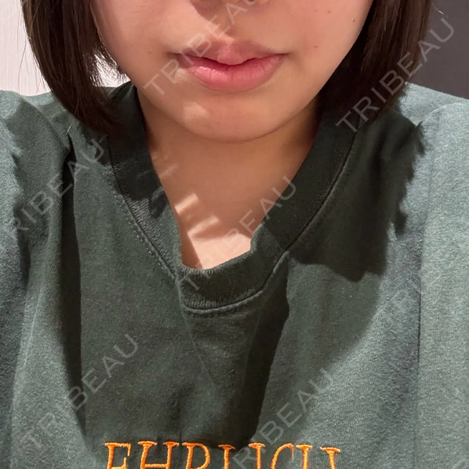 施術前の写真