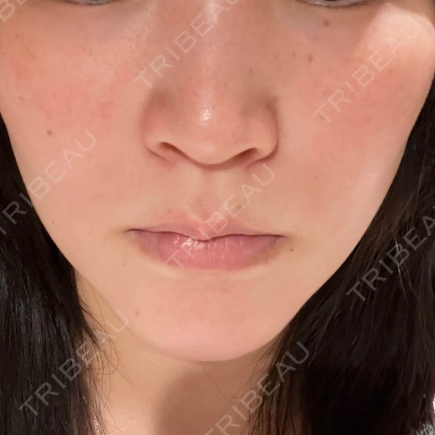 施術前の写真
