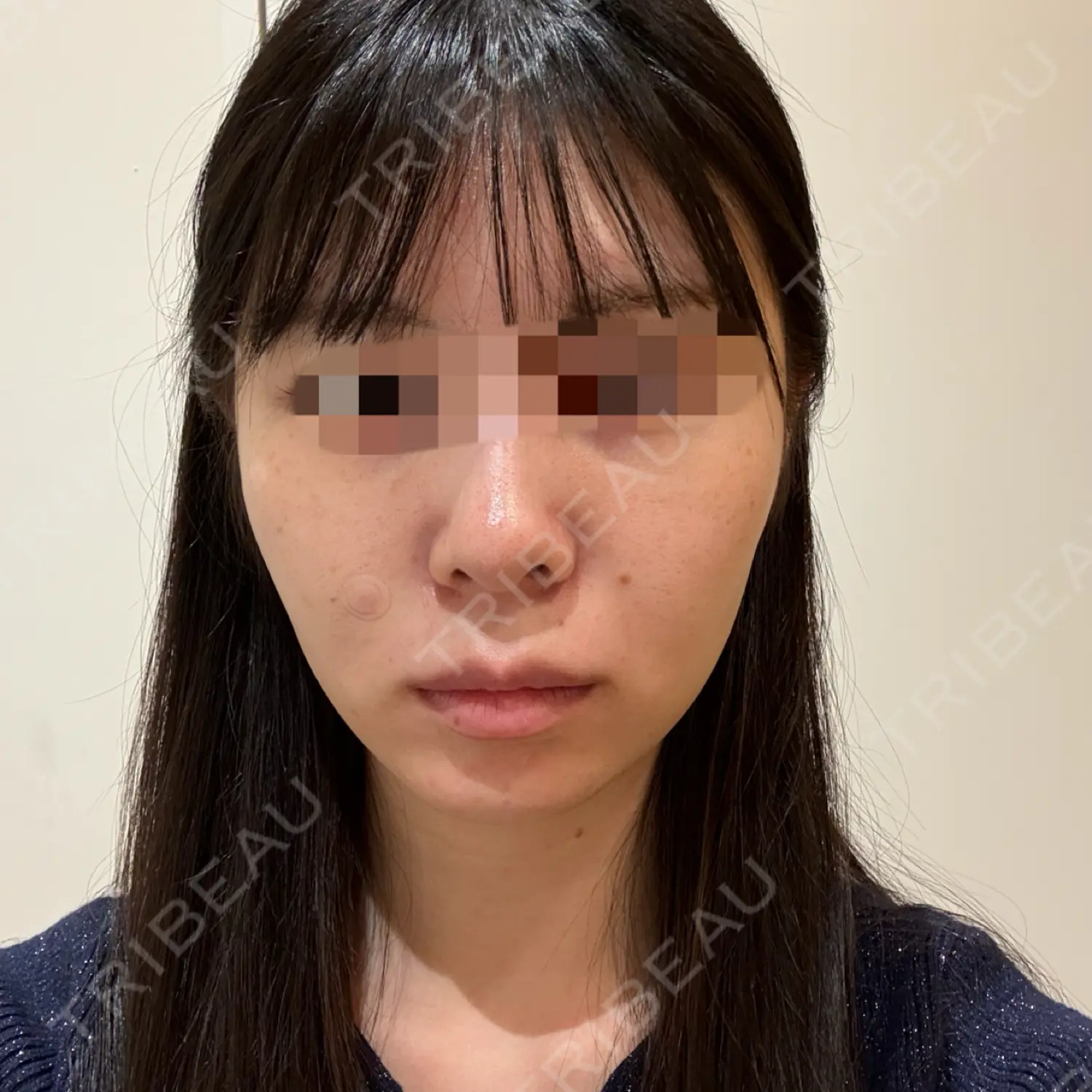 施術前の写真