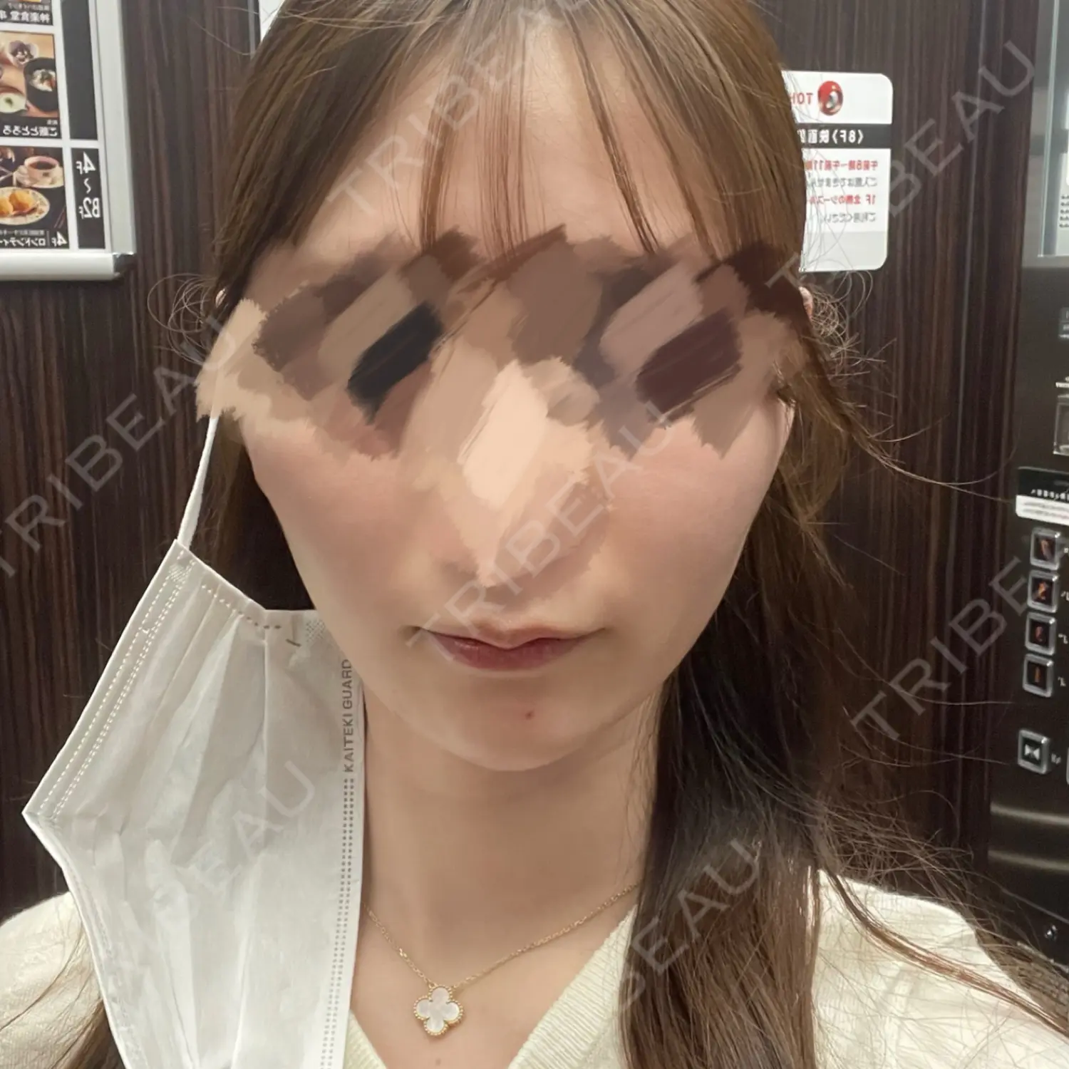 施術前の写真