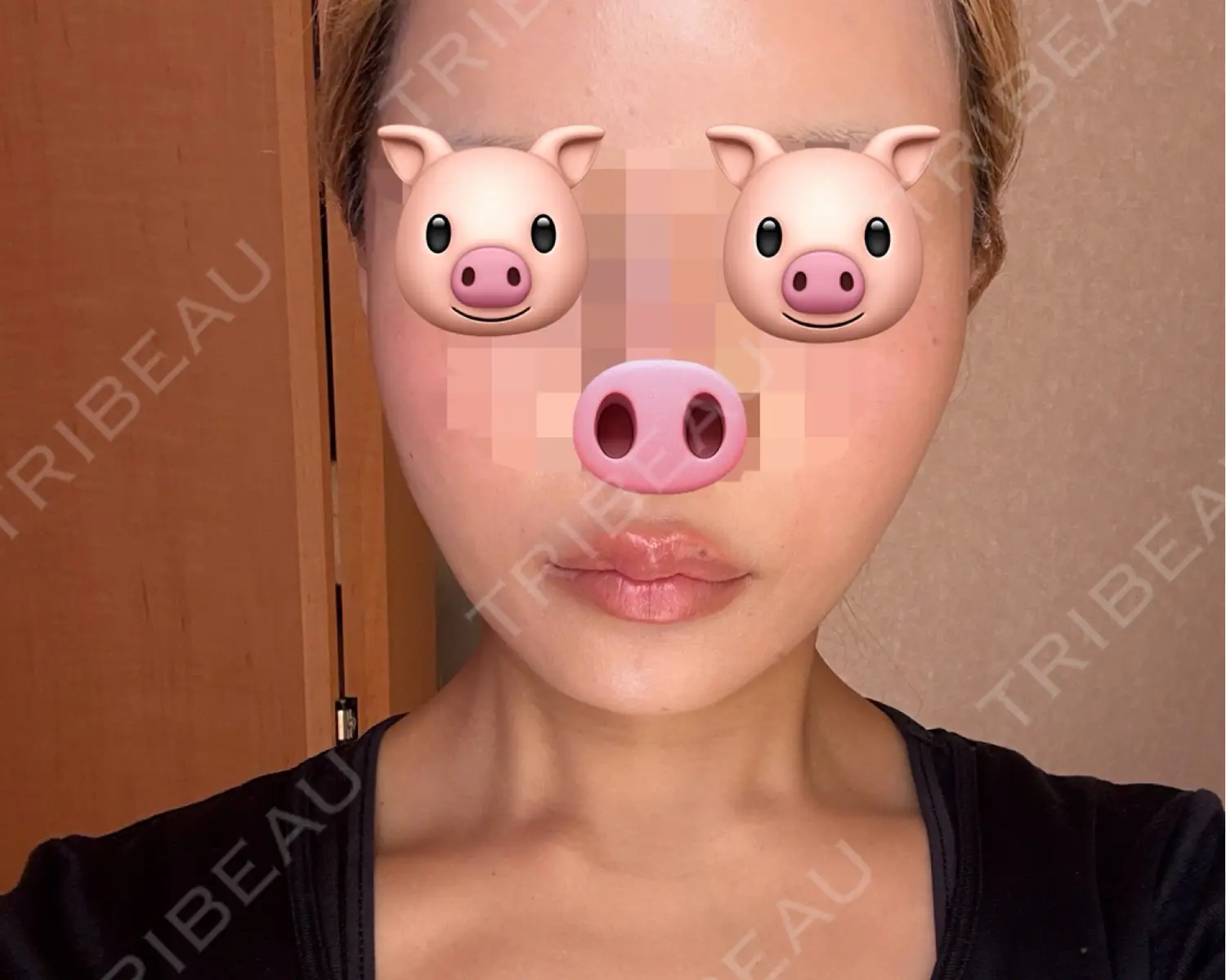施術前の写真