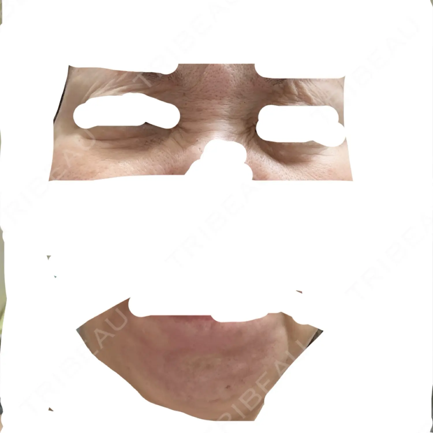 施術前の写真