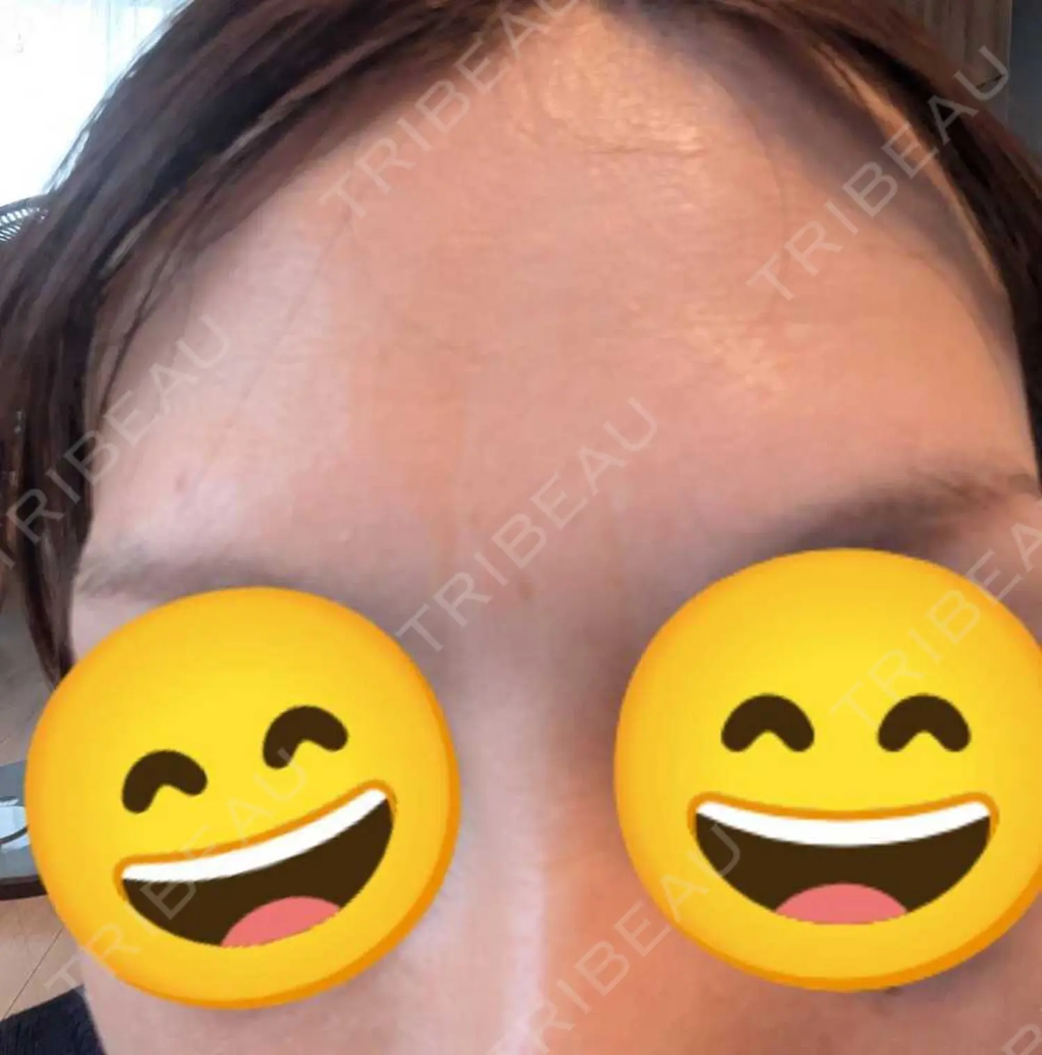 施術前の写真