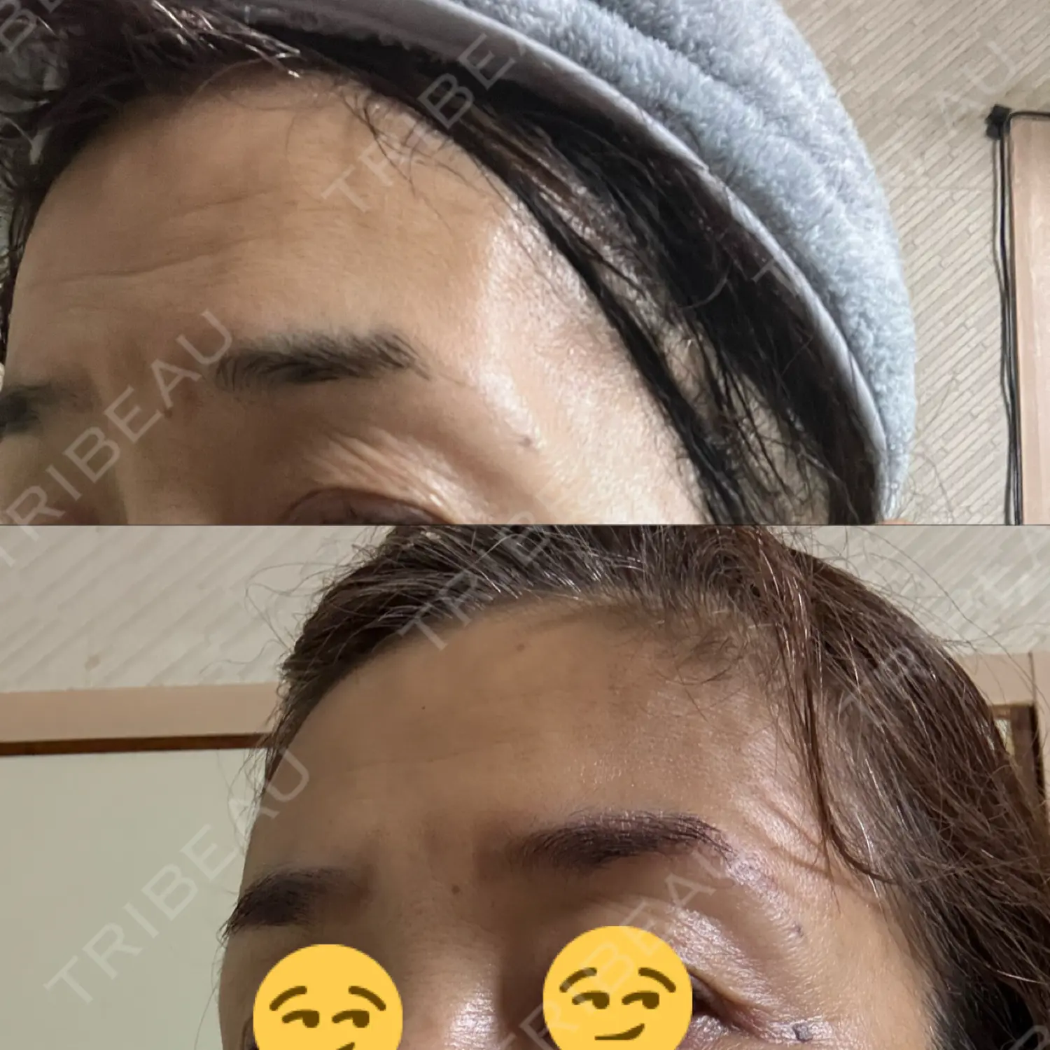 施術前の写真