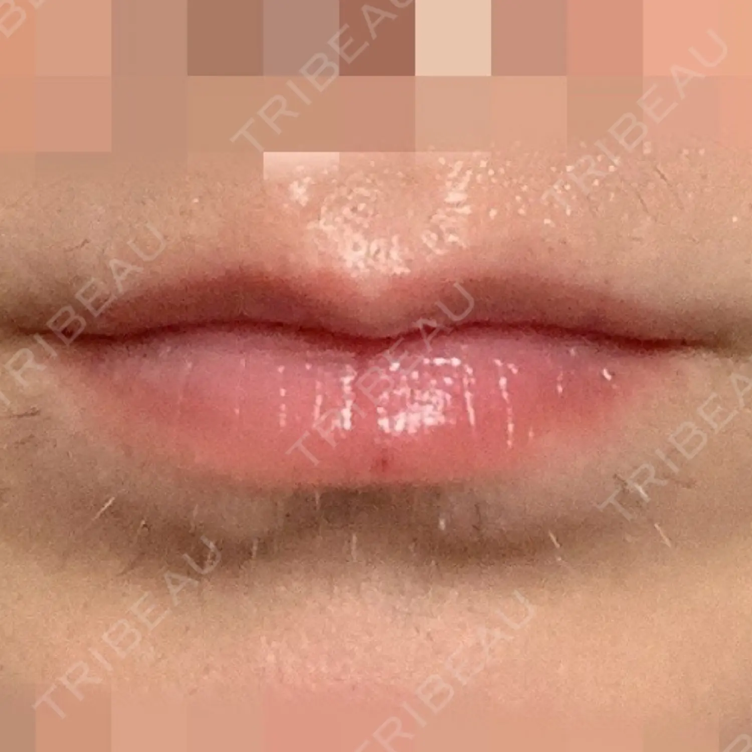 施術前の写真