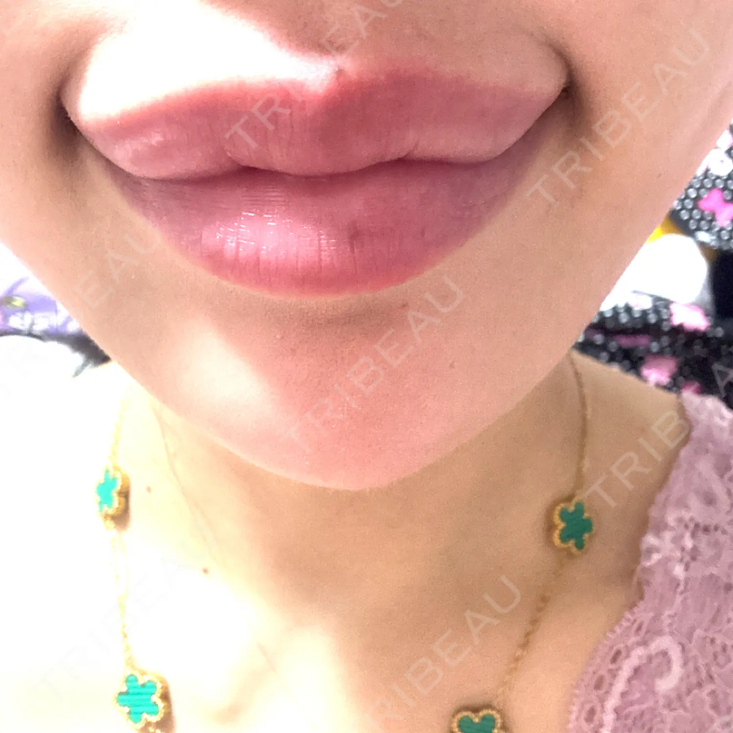 施術前の写真