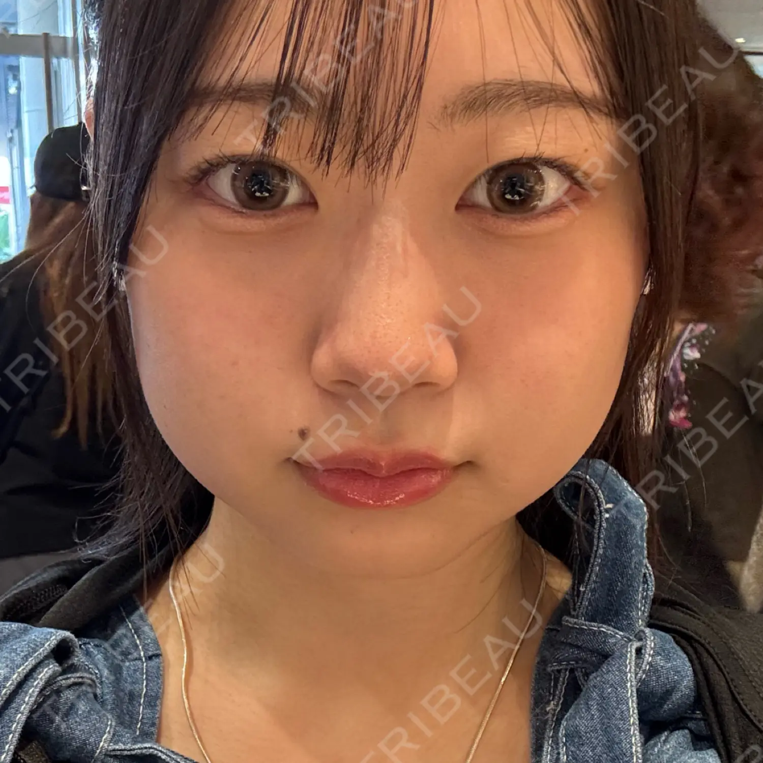 施術前の写真