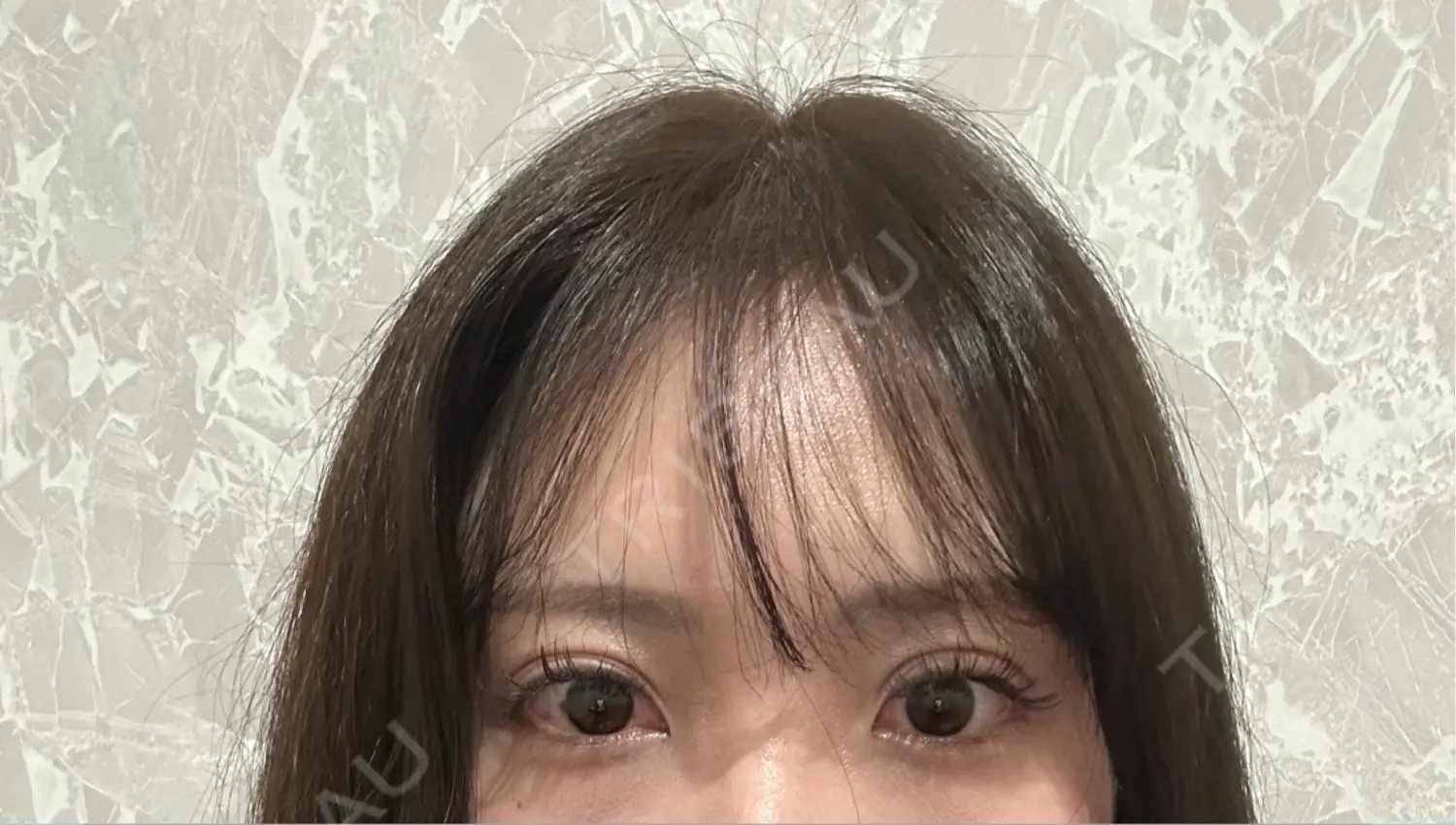施術前の写真