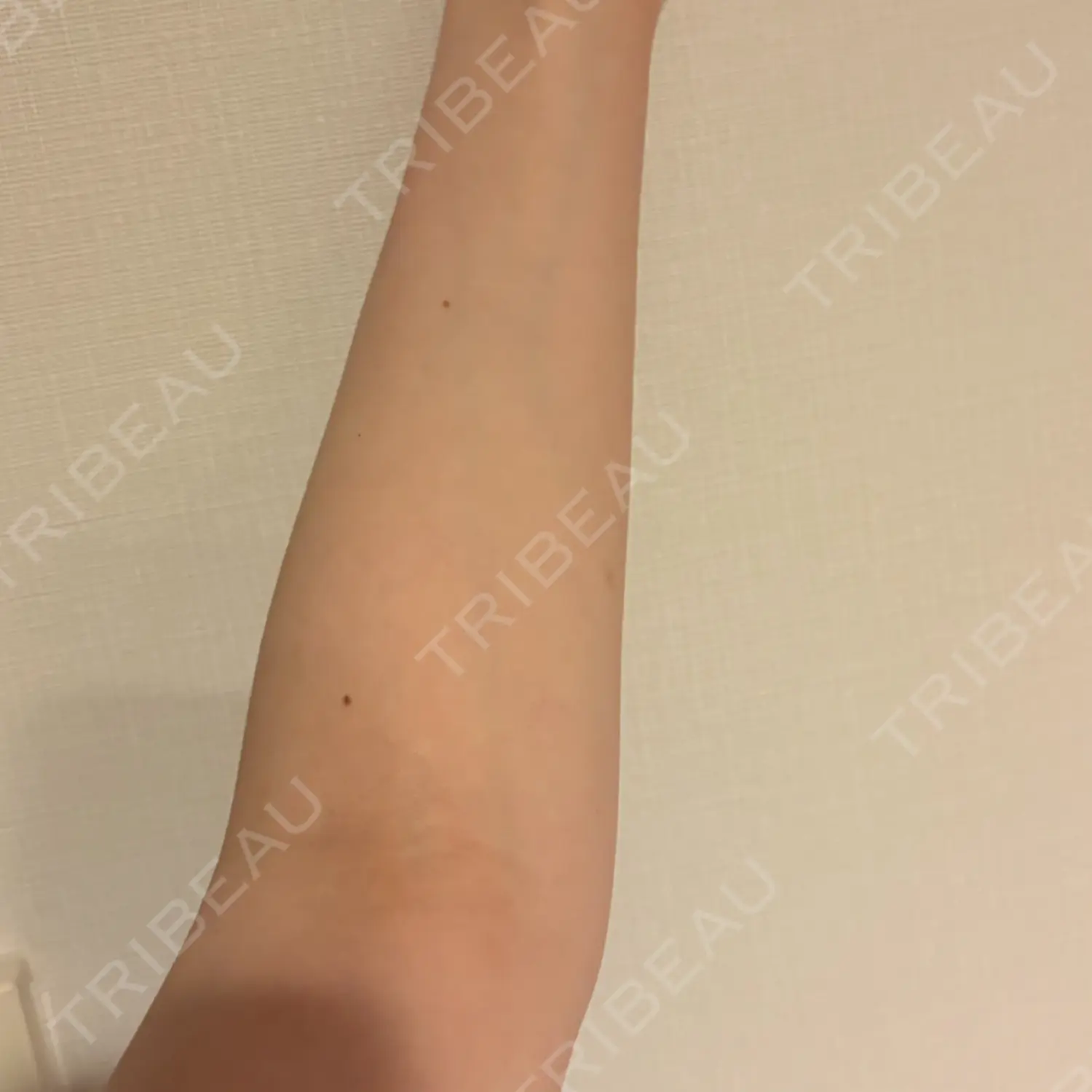 施術前の写真