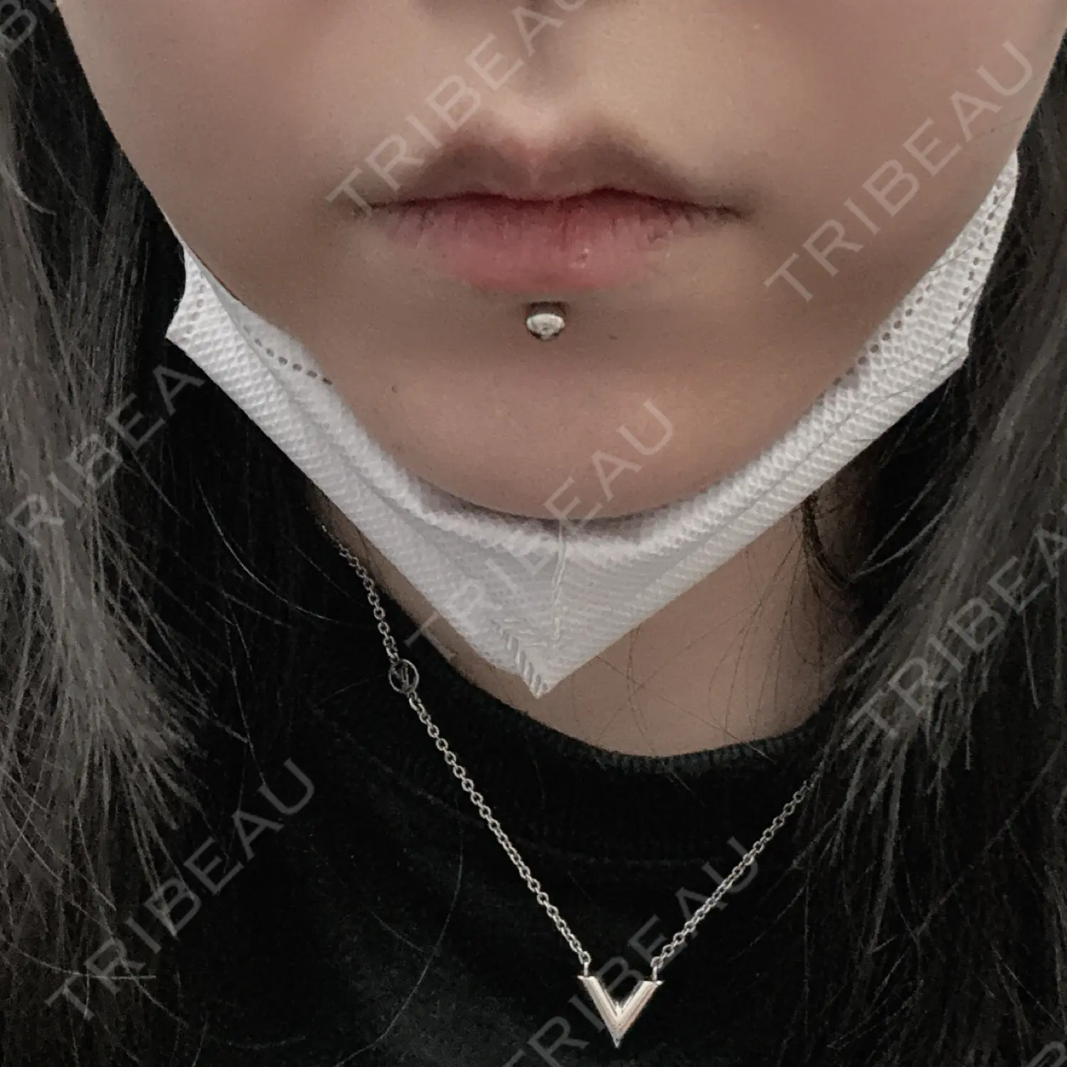 施術前の写真