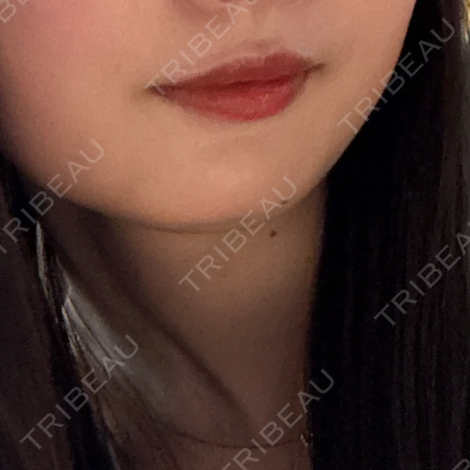 施術前の写真
