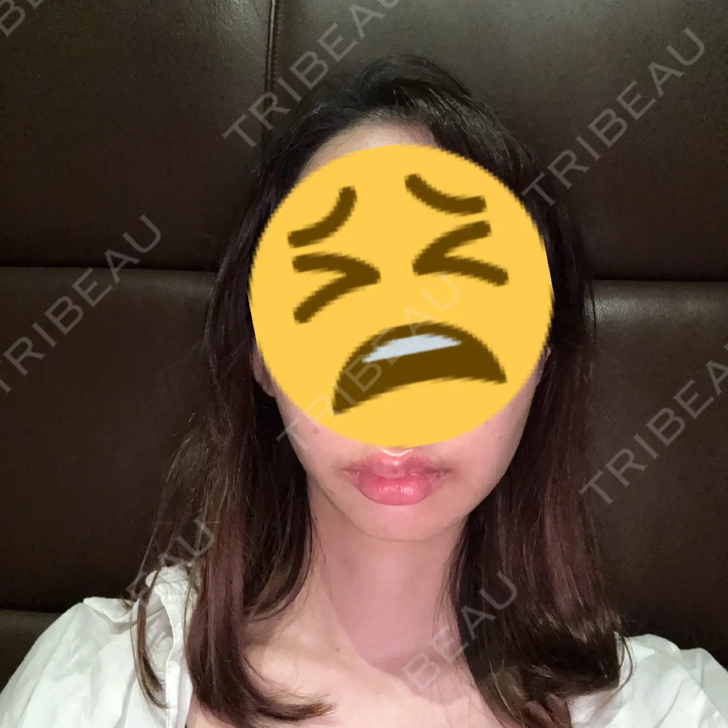 施術前の写真