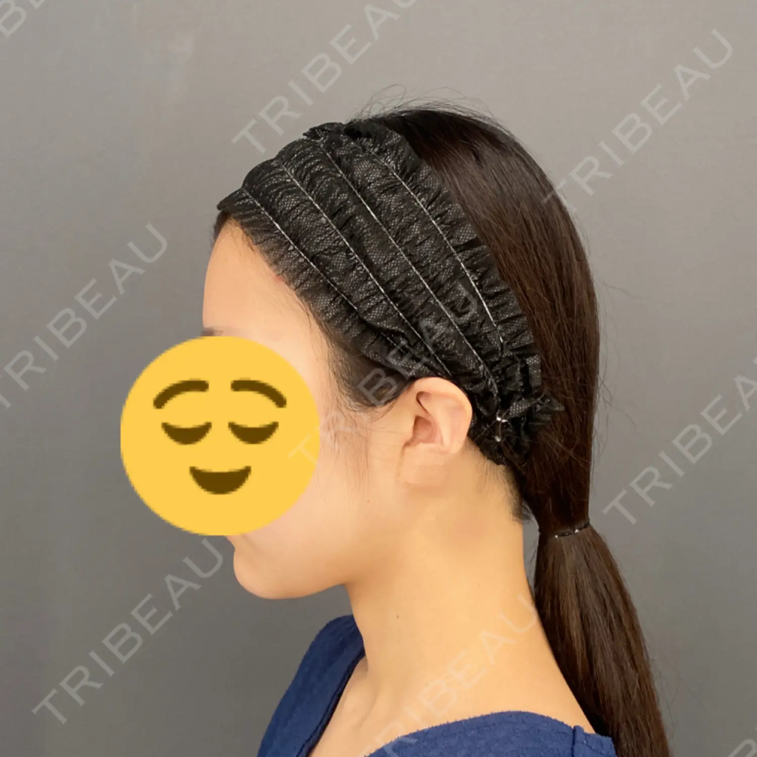 施術前の写真