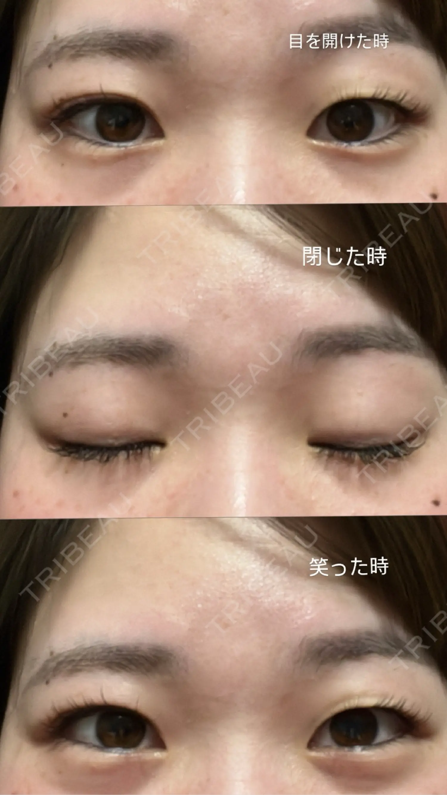 施術前の写真