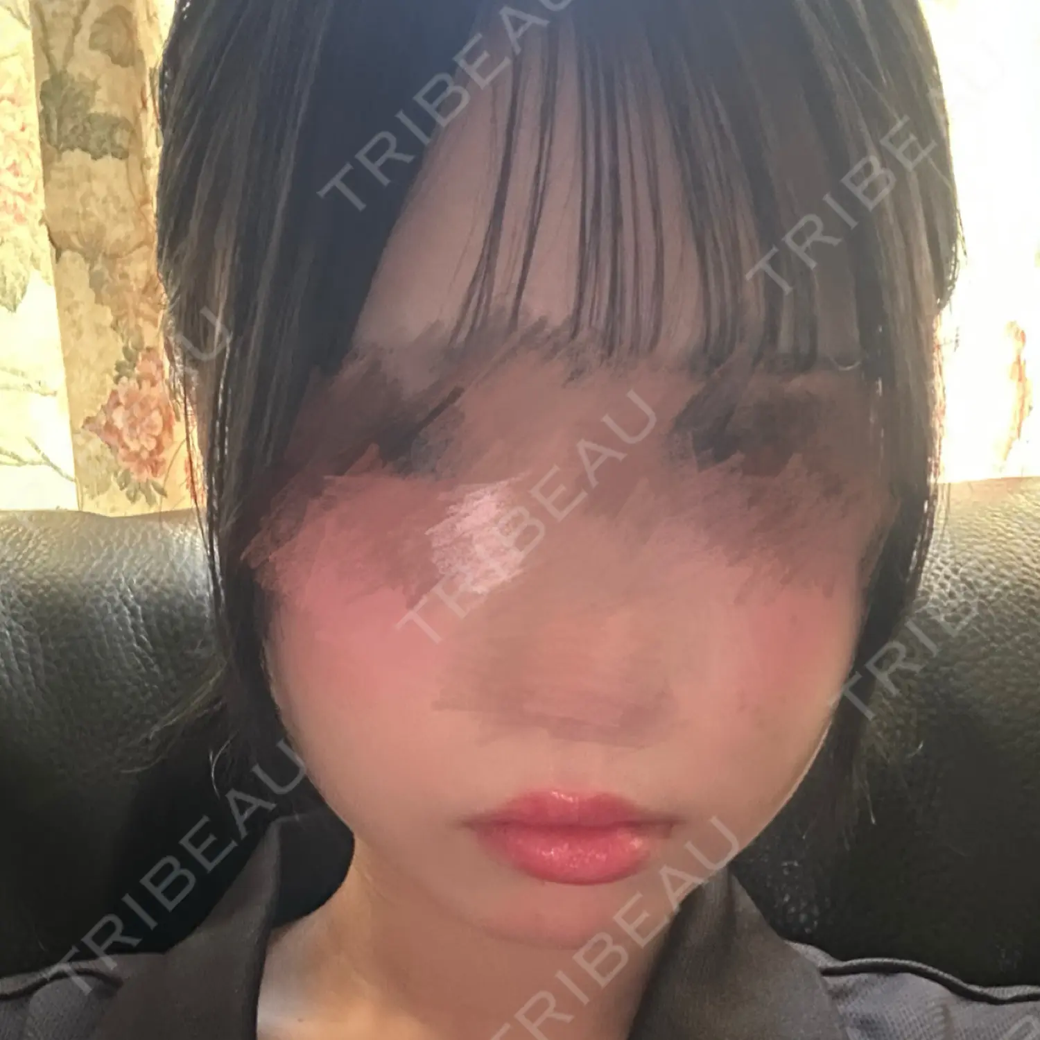 施術前の写真