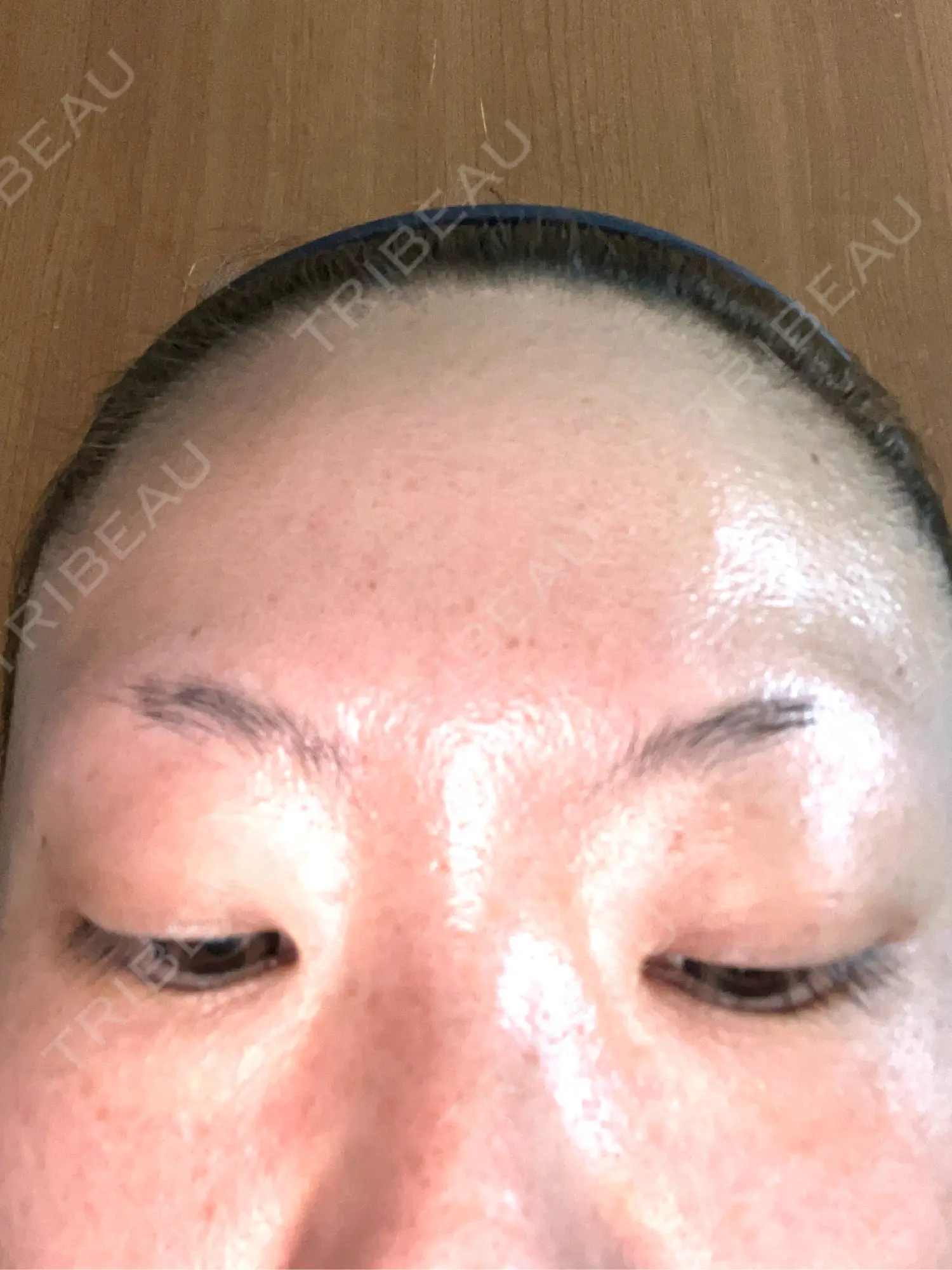 施術前の写真