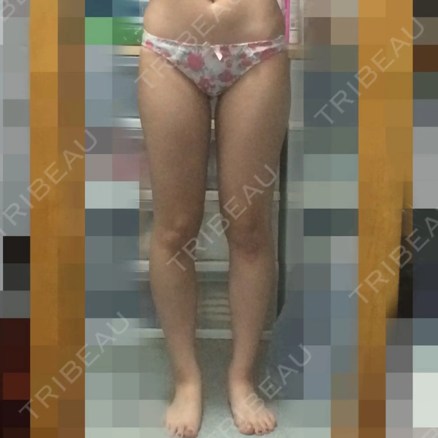 施術前の写真