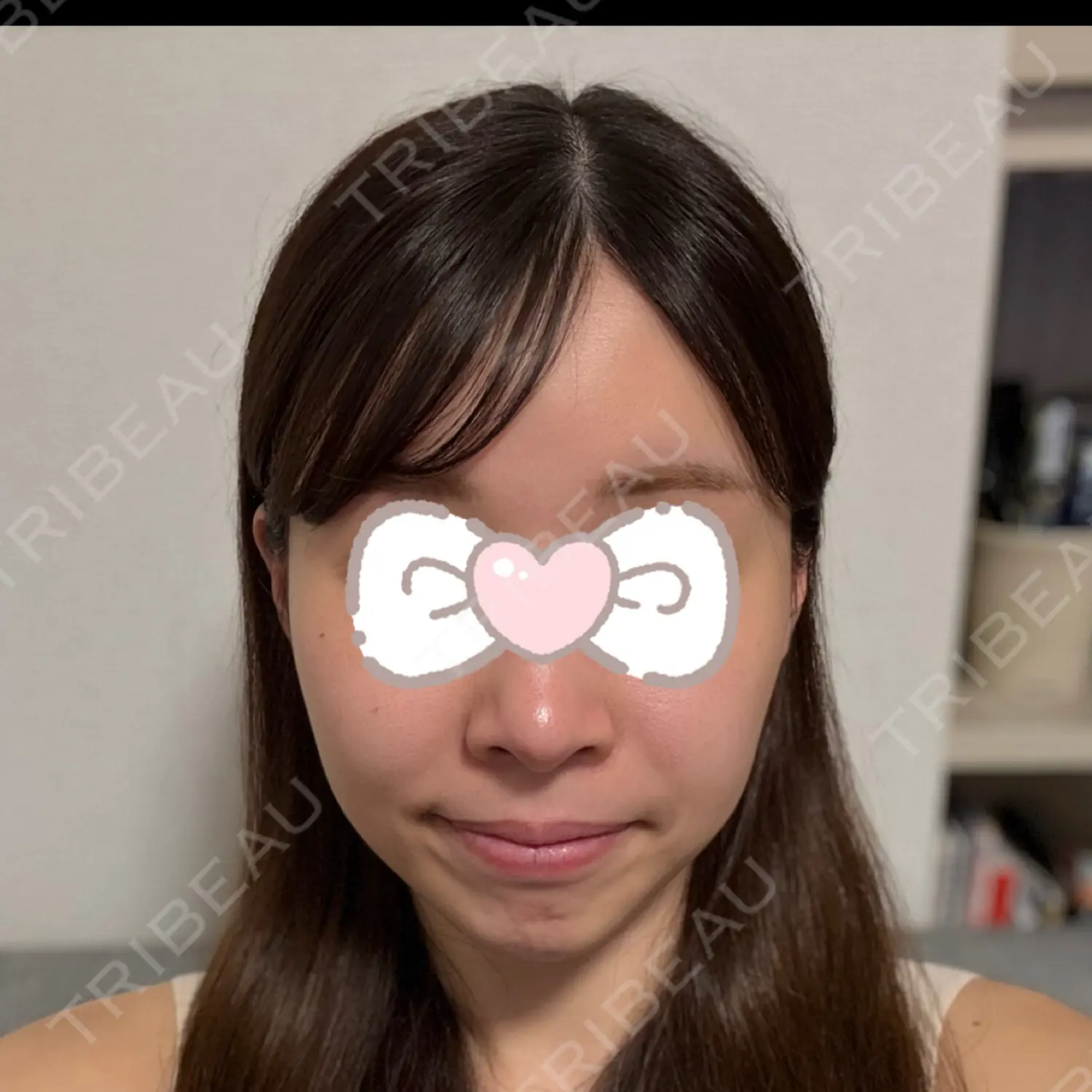 施術前の写真