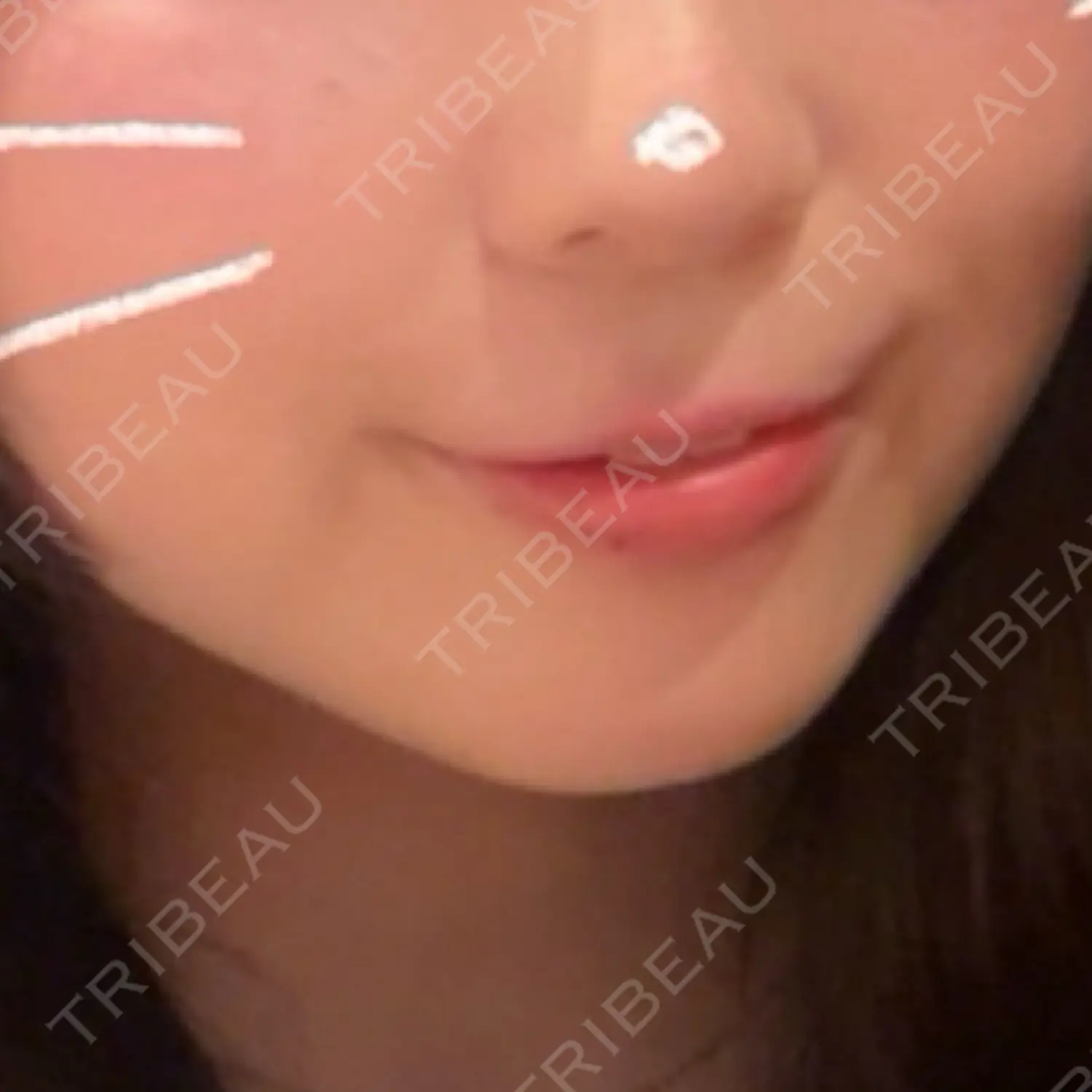 施術前の写真