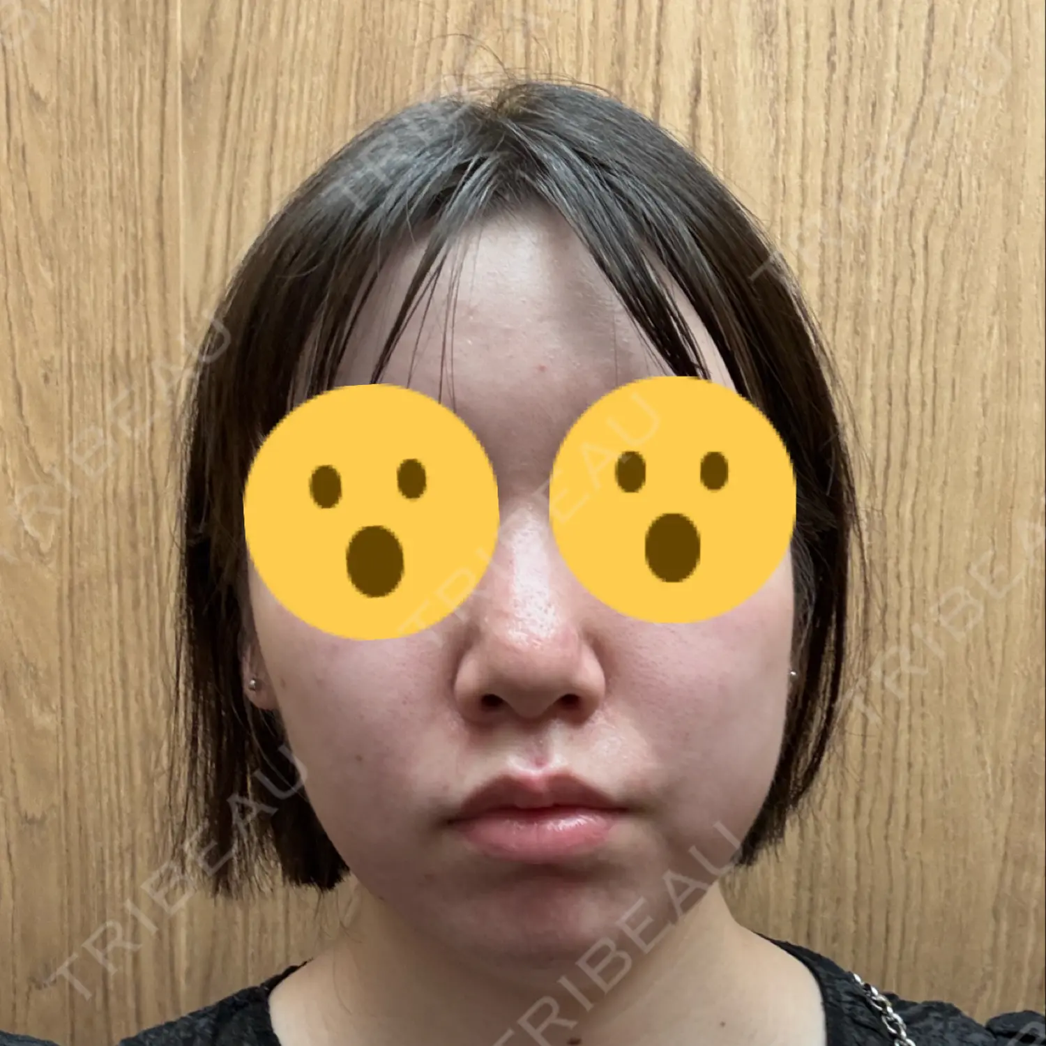 施術前の写真