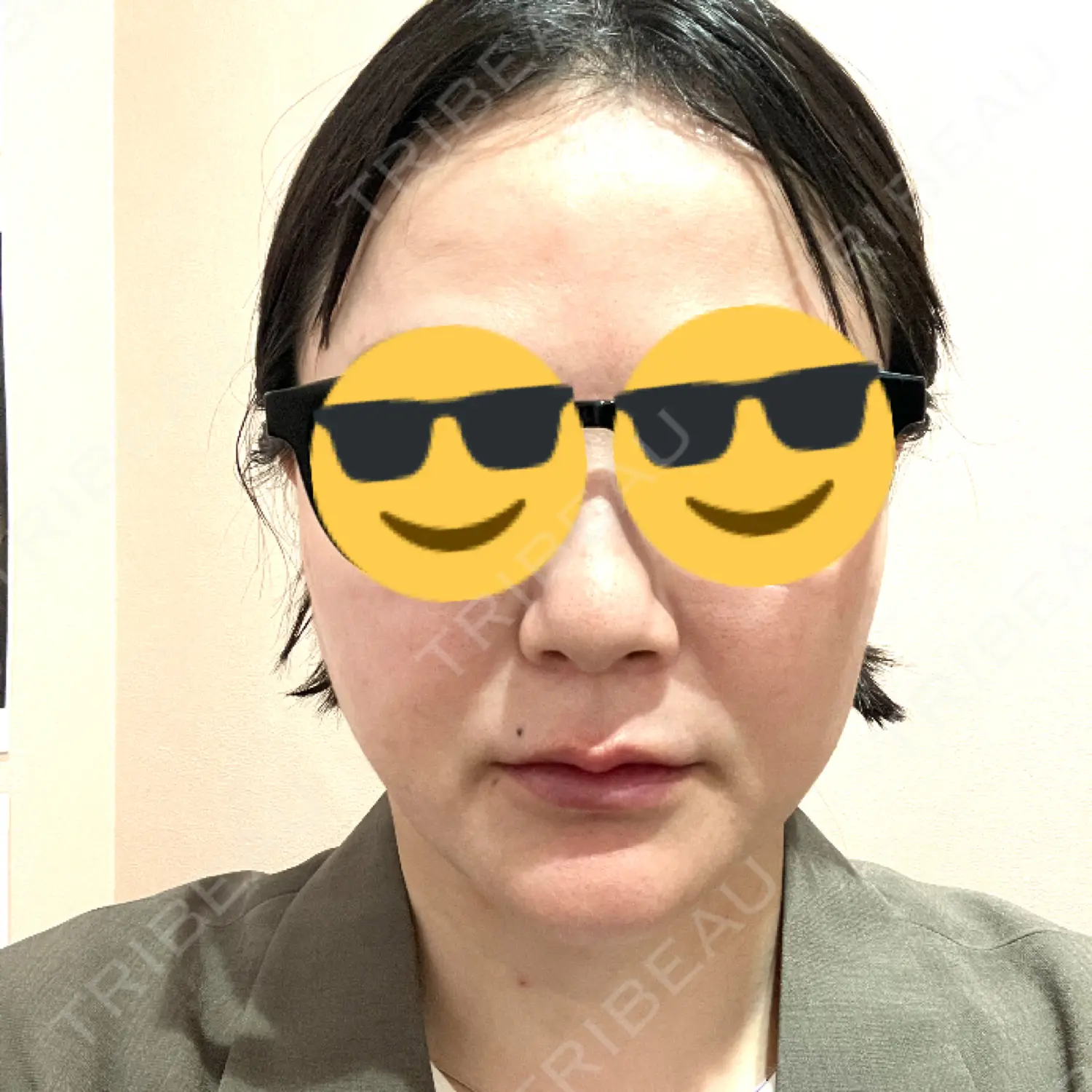 施術前の写真
