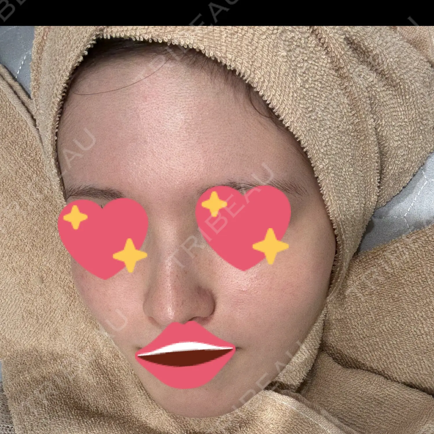 施術前の写真