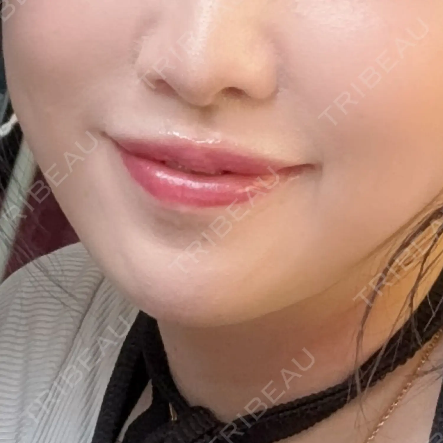 施術前の写真