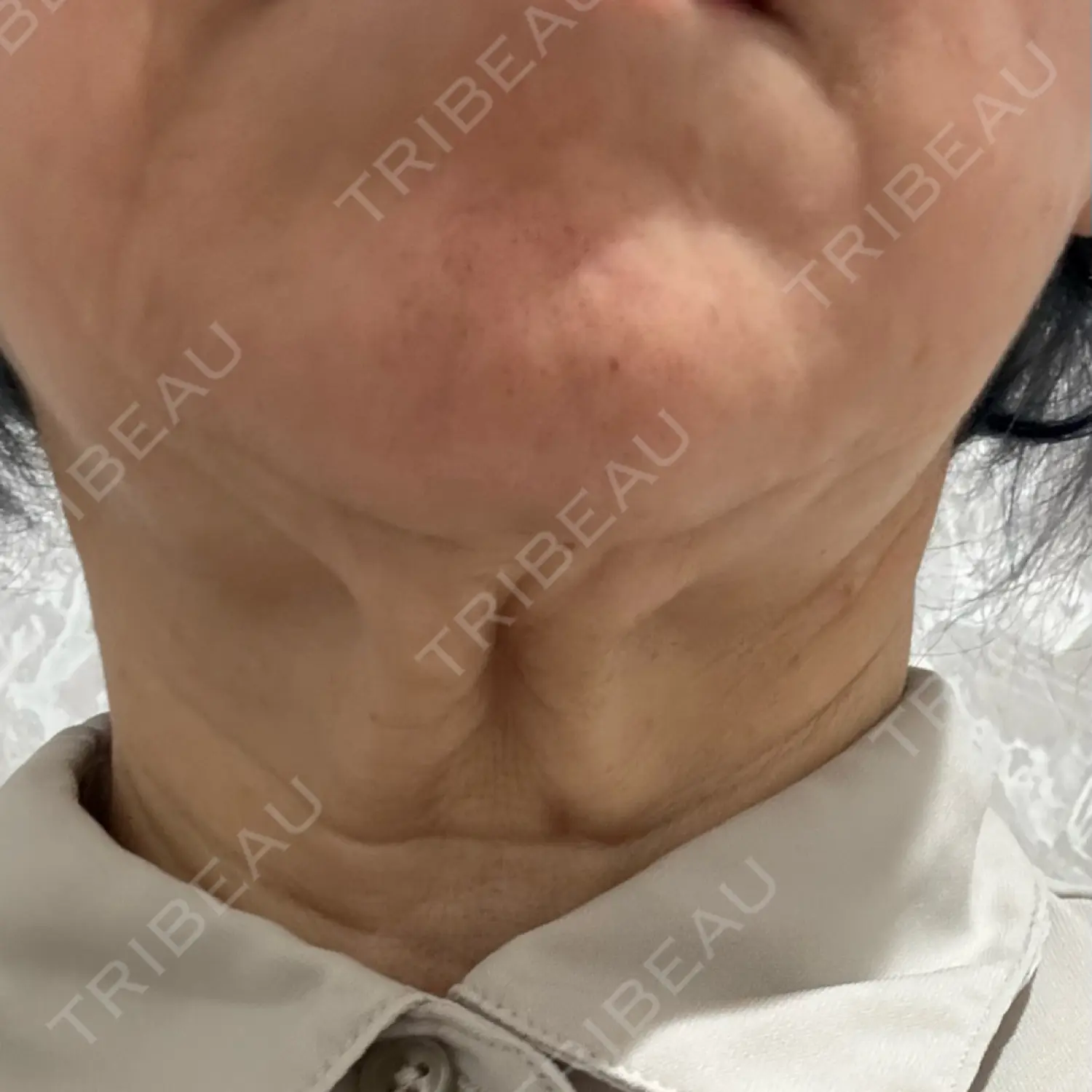 施術前の写真
