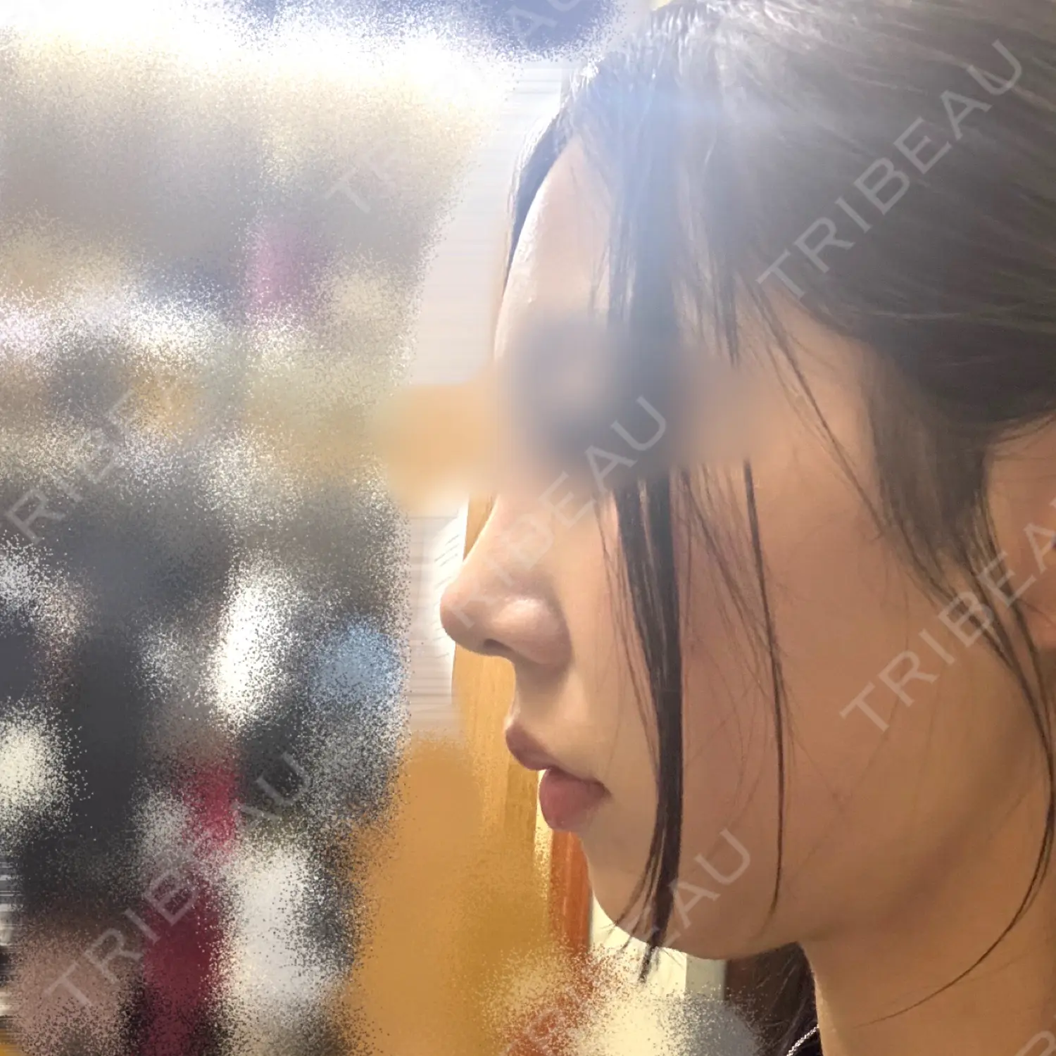 施術前の写真