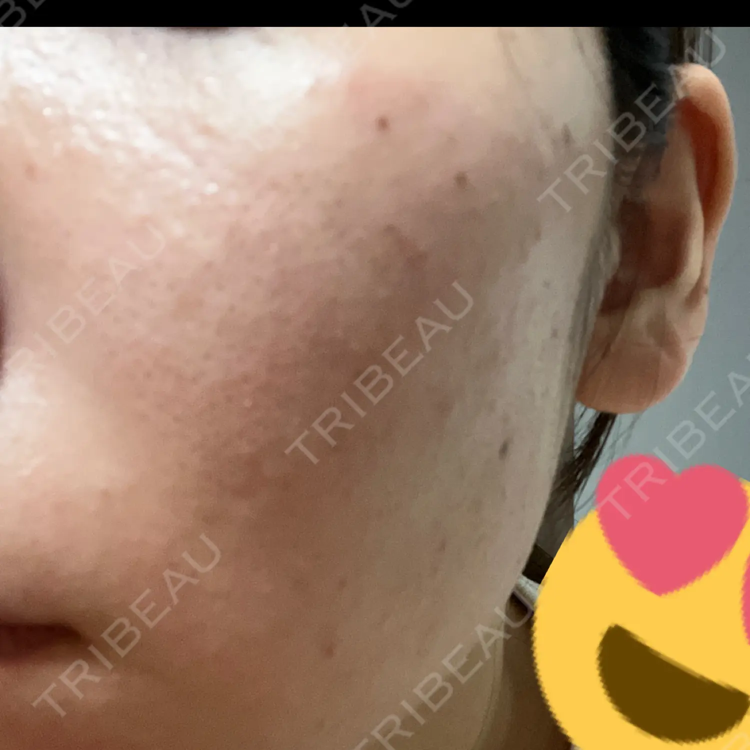 施術前の写真