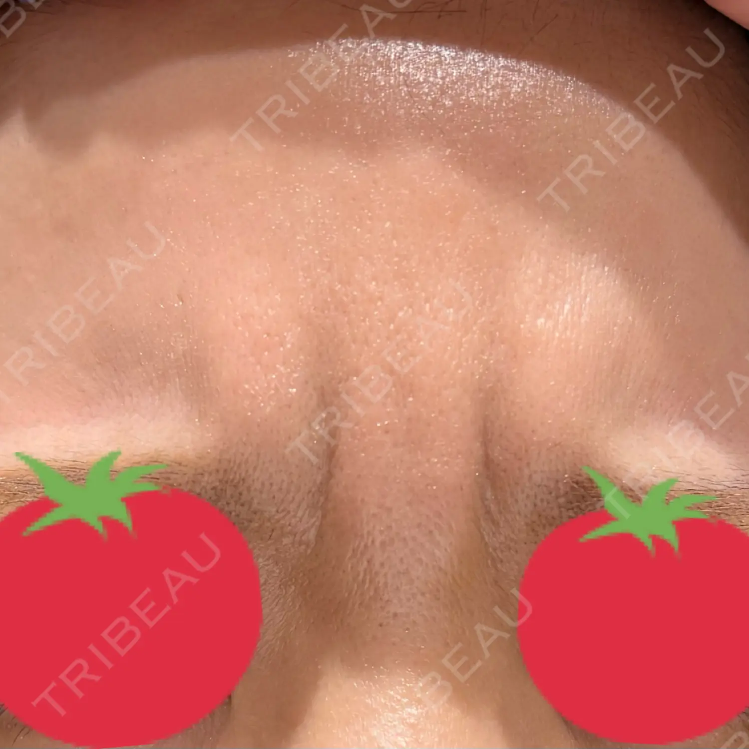 施術前の写真