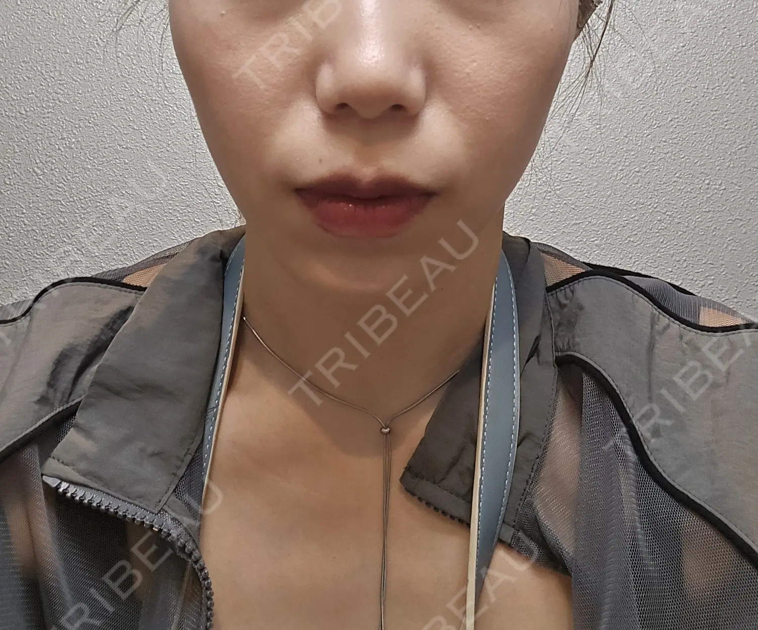施術前の写真