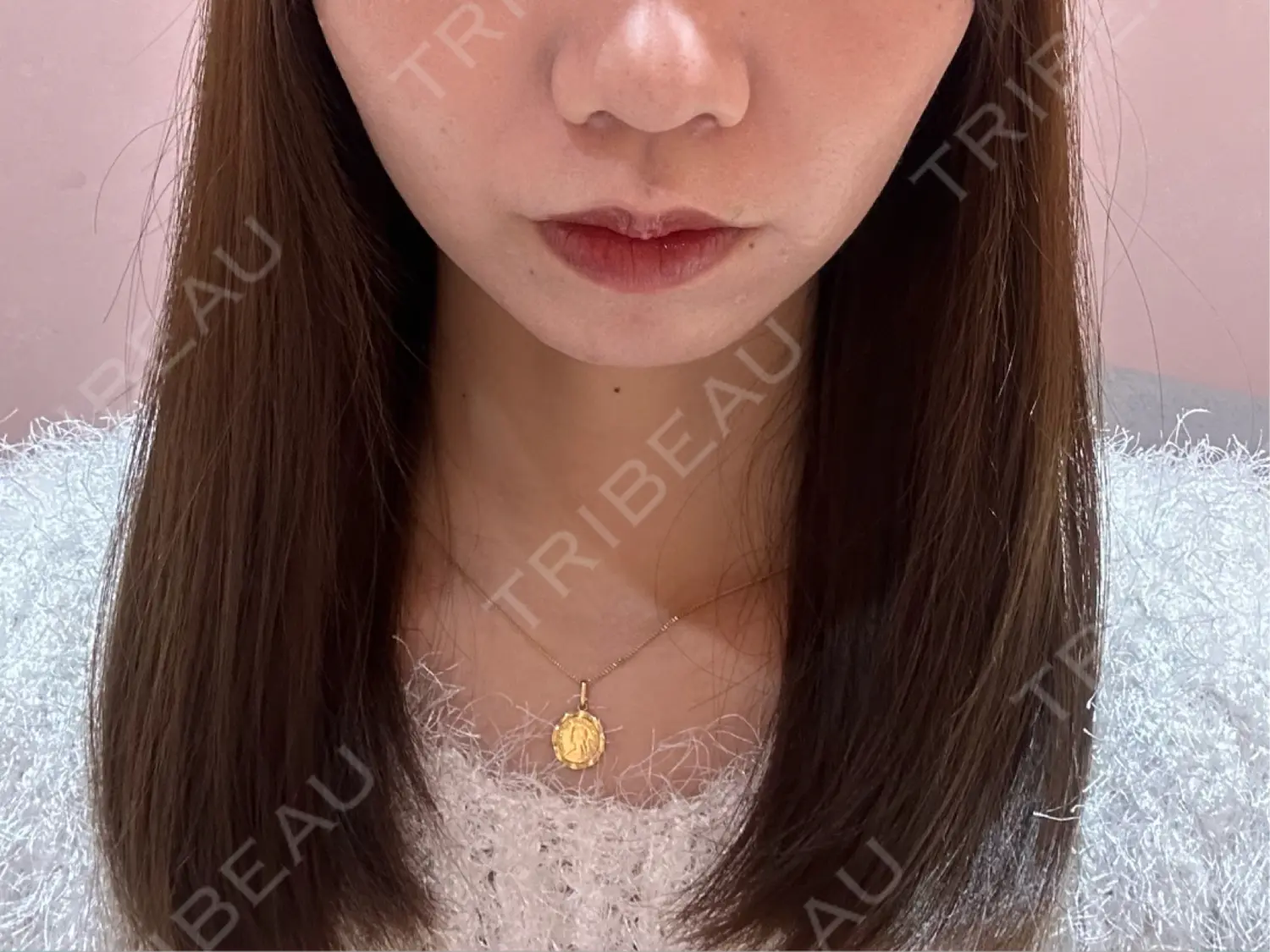 施術前の写真