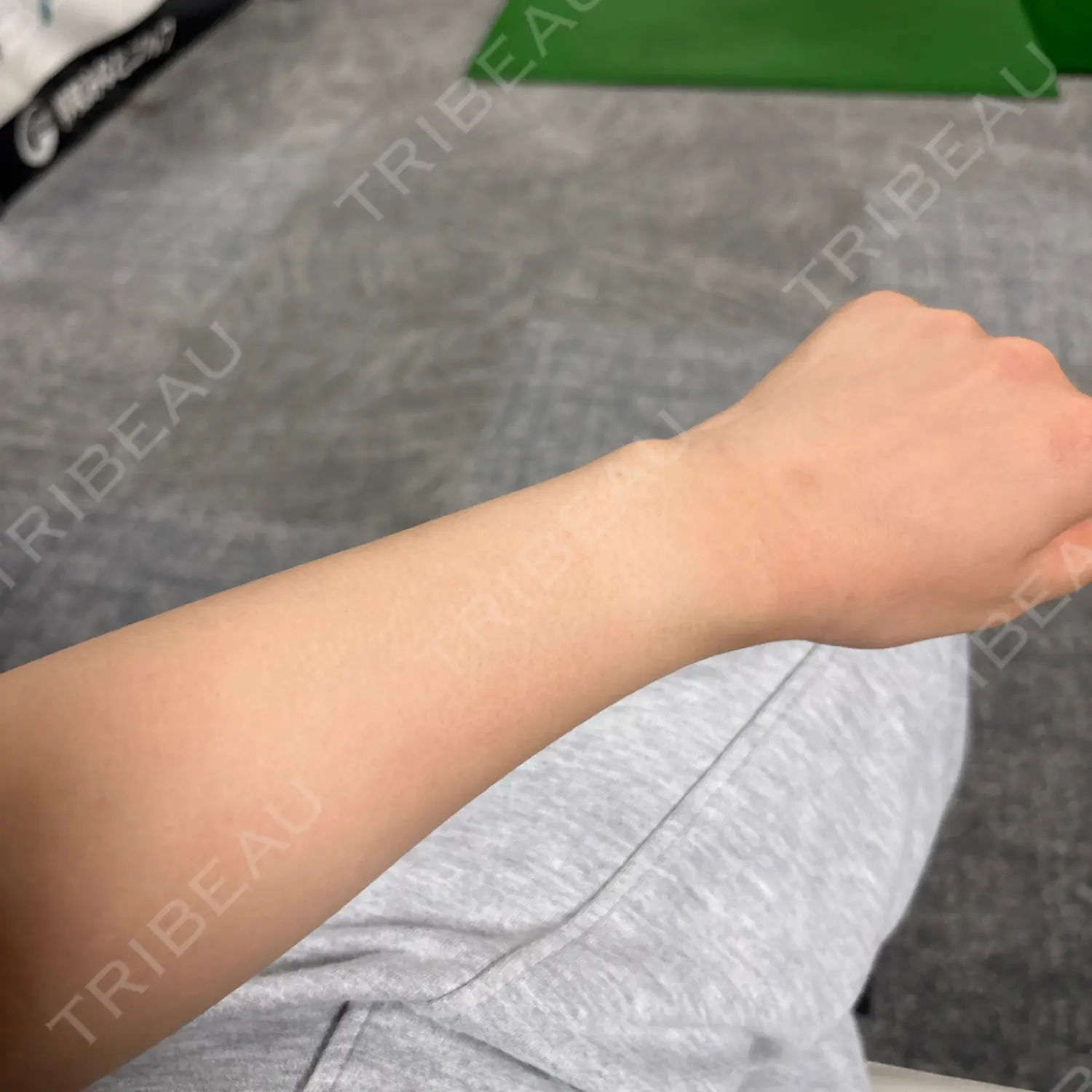 施術前の写真