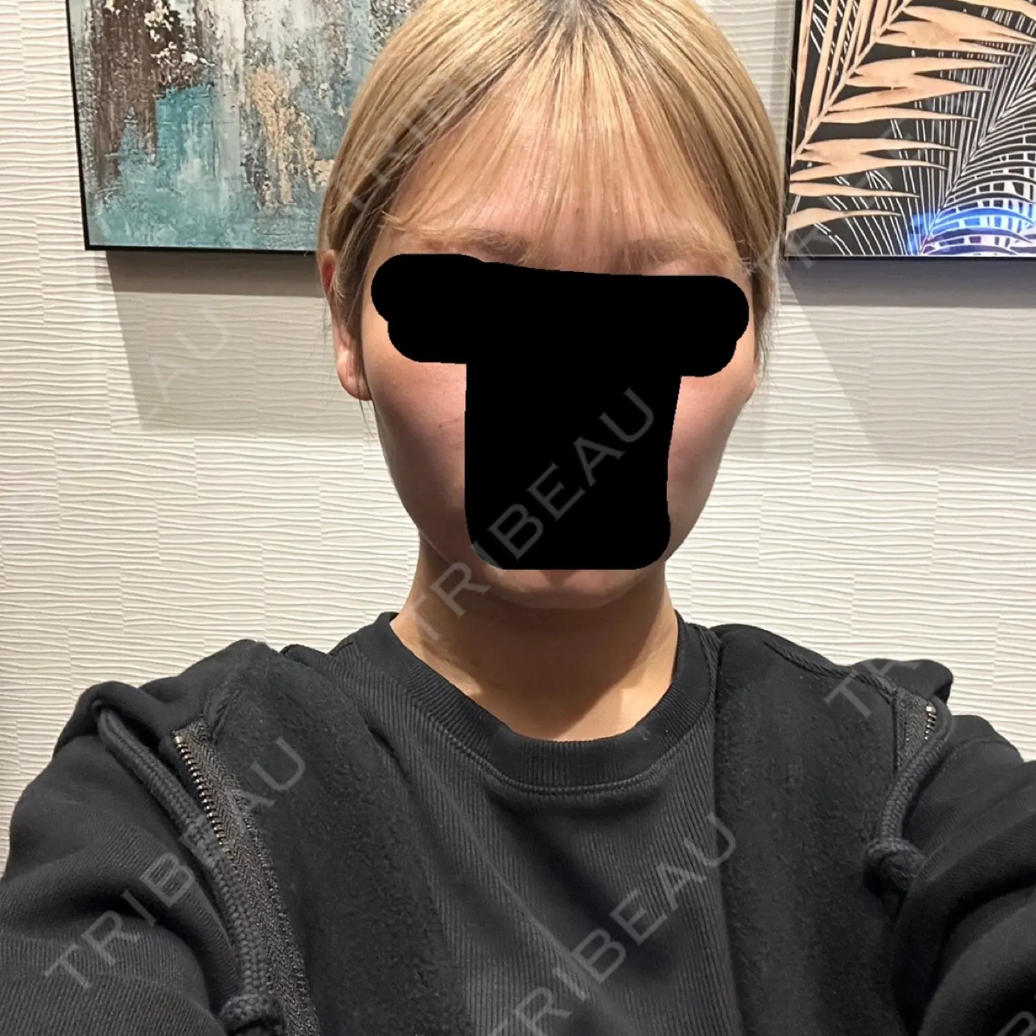 施術前の写真
