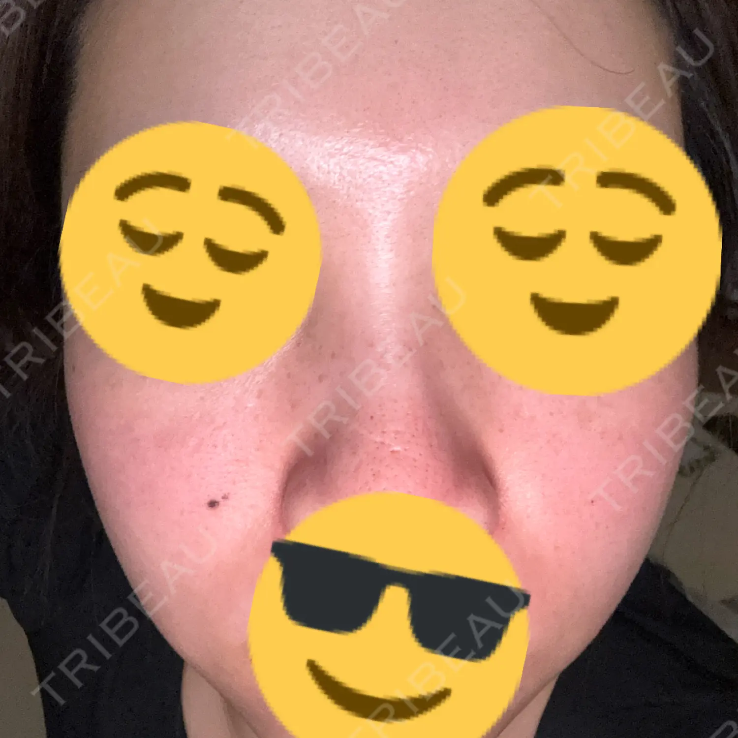 施術前の写真