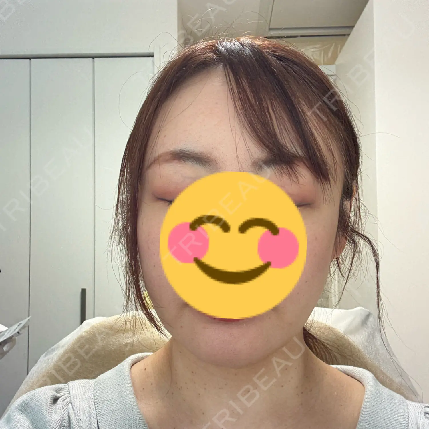 施術前の写真