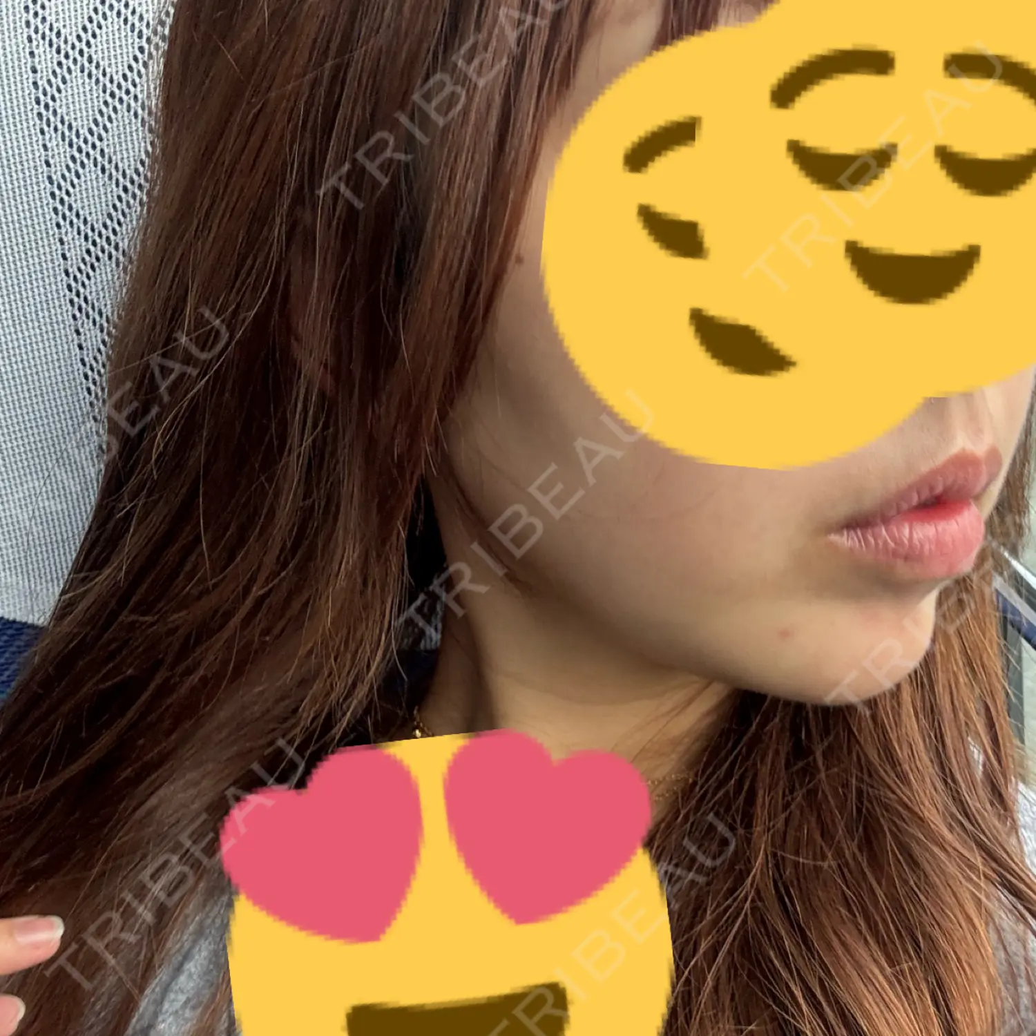 施術前の写真
