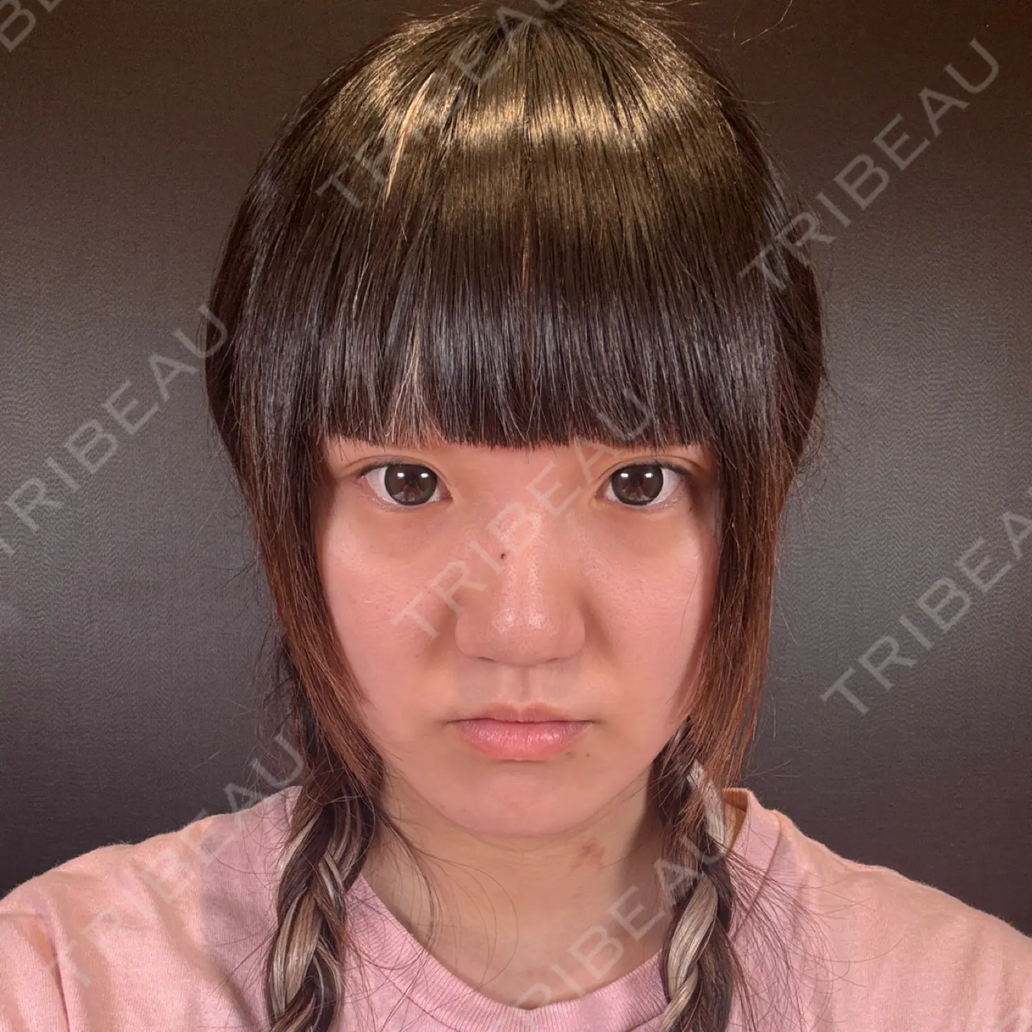 施術前の写真