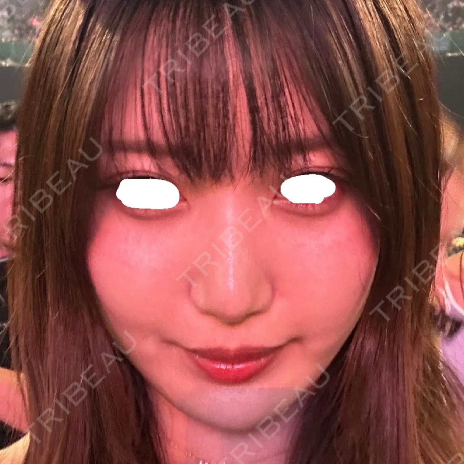 施術前の写真