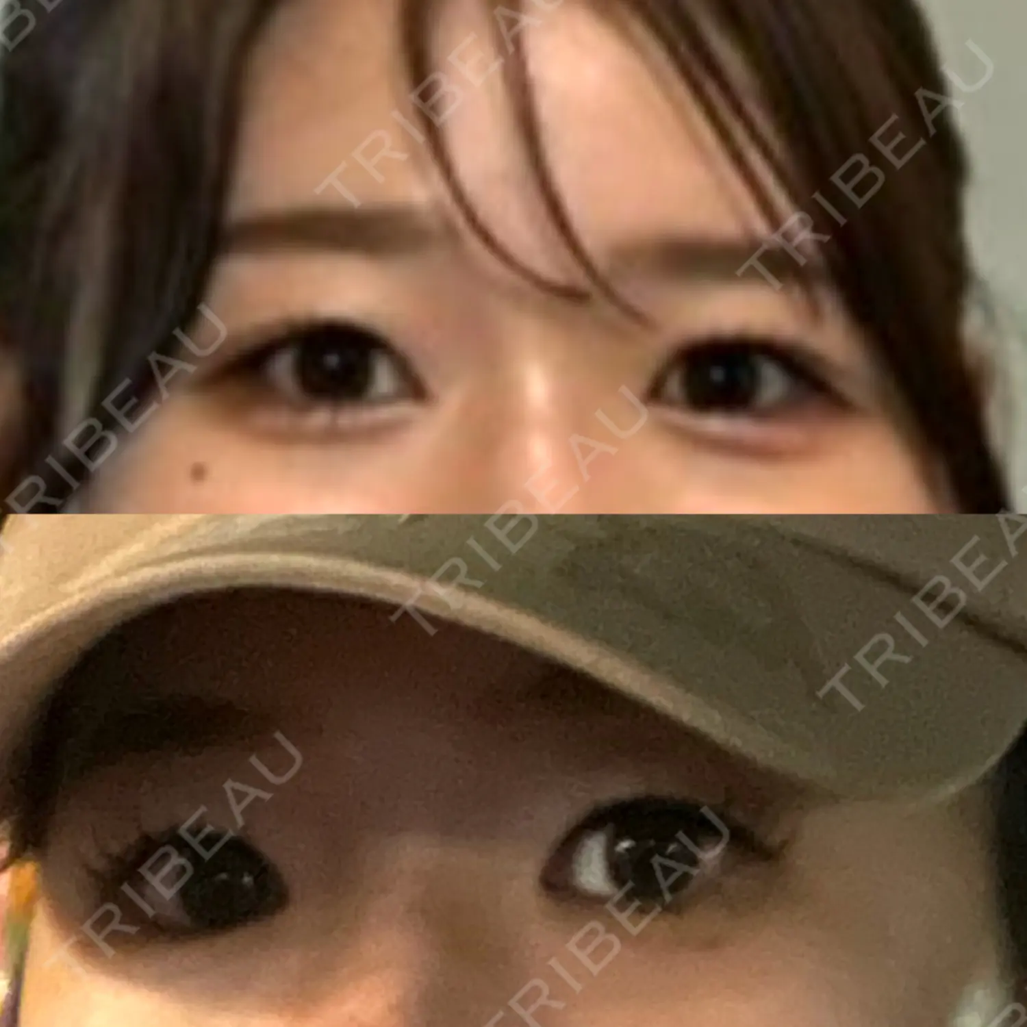 施術前の写真