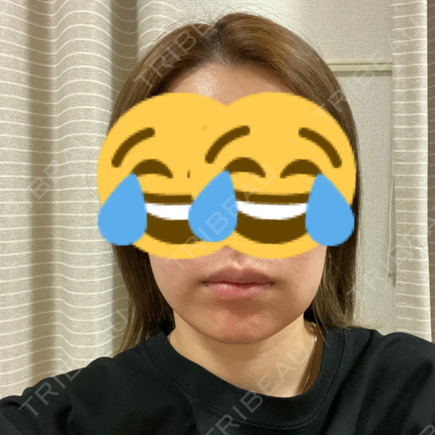 施術前の写真