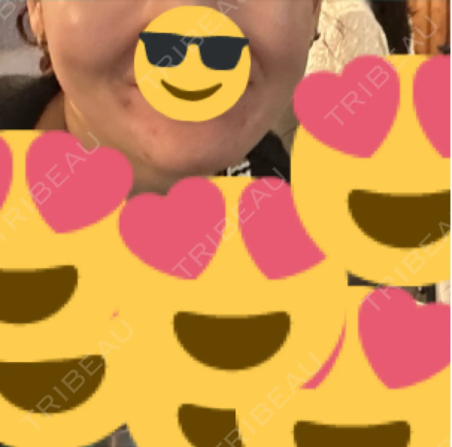施術前の写真