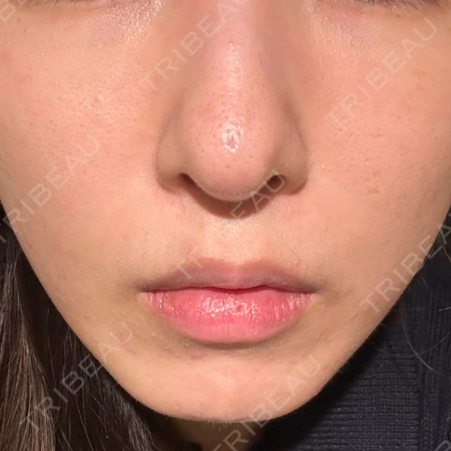施術前の写真