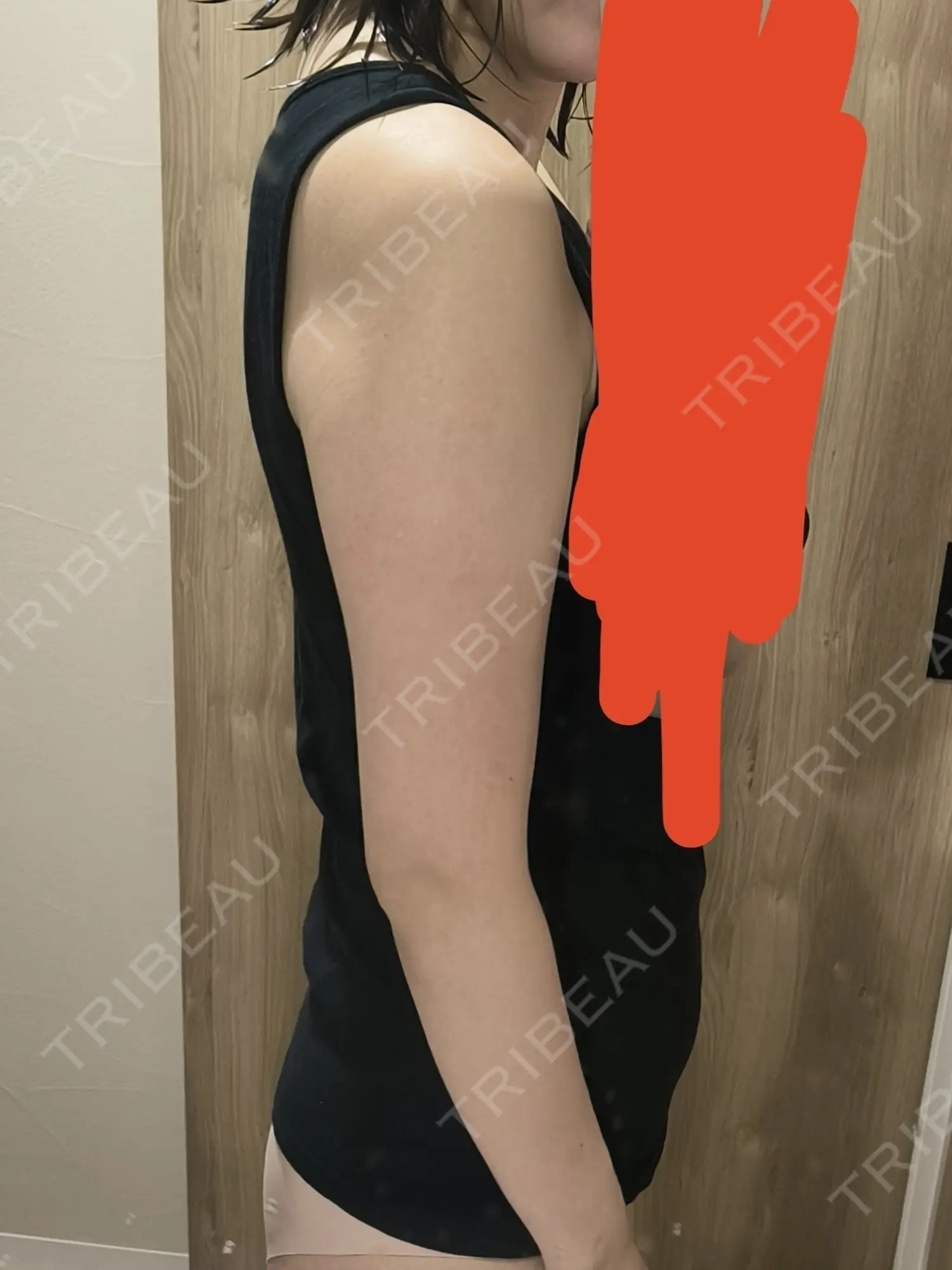 施術前の写真