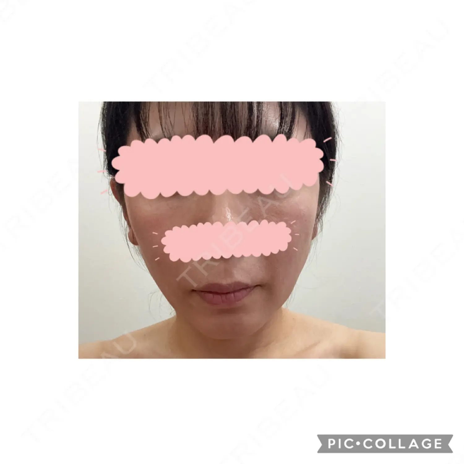 施術前の写真