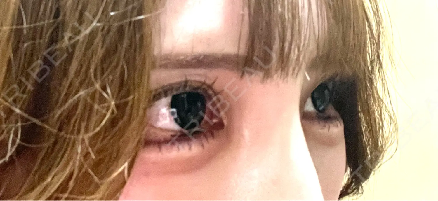 施術前の写真