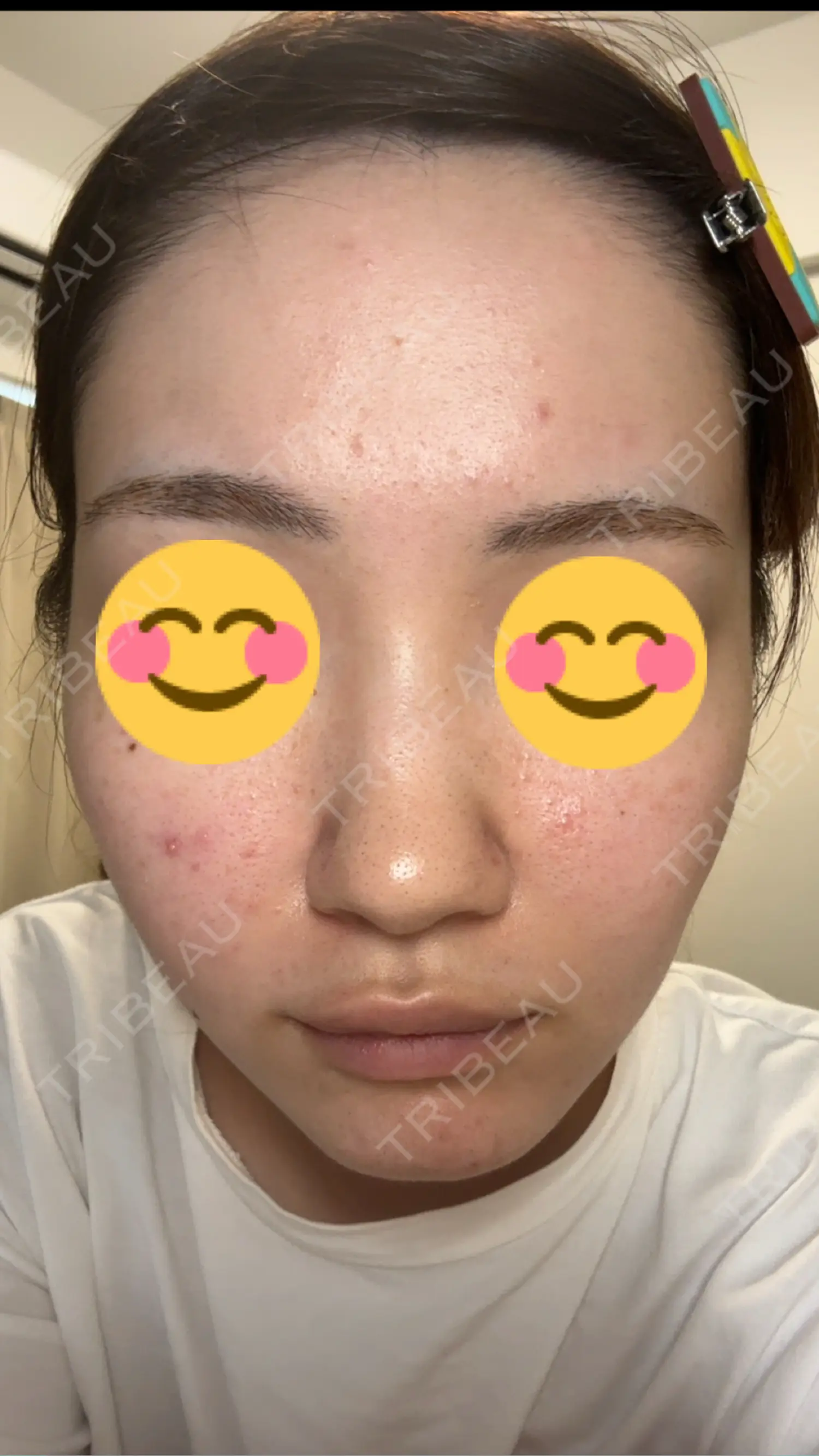 施術前の写真