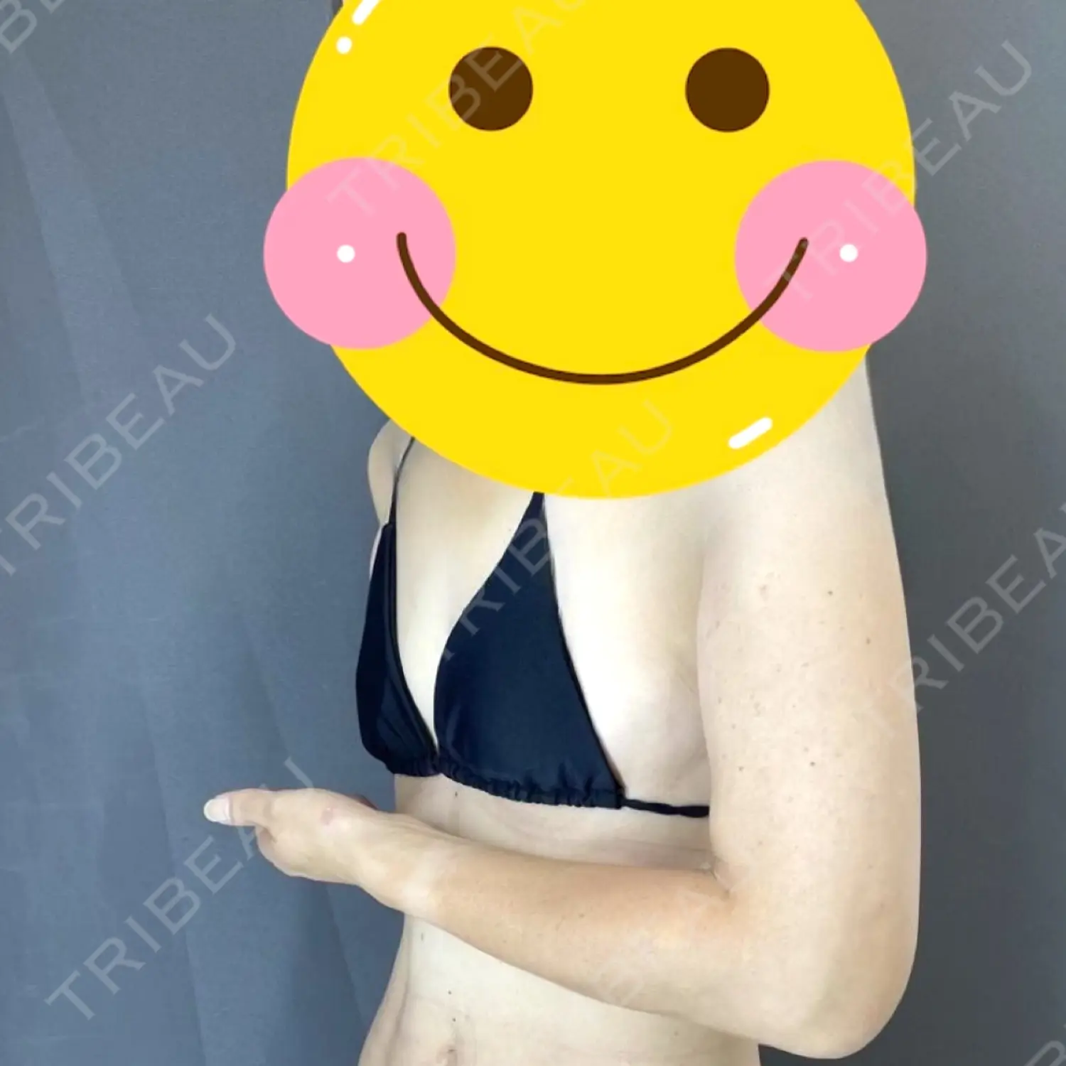 施術前の写真